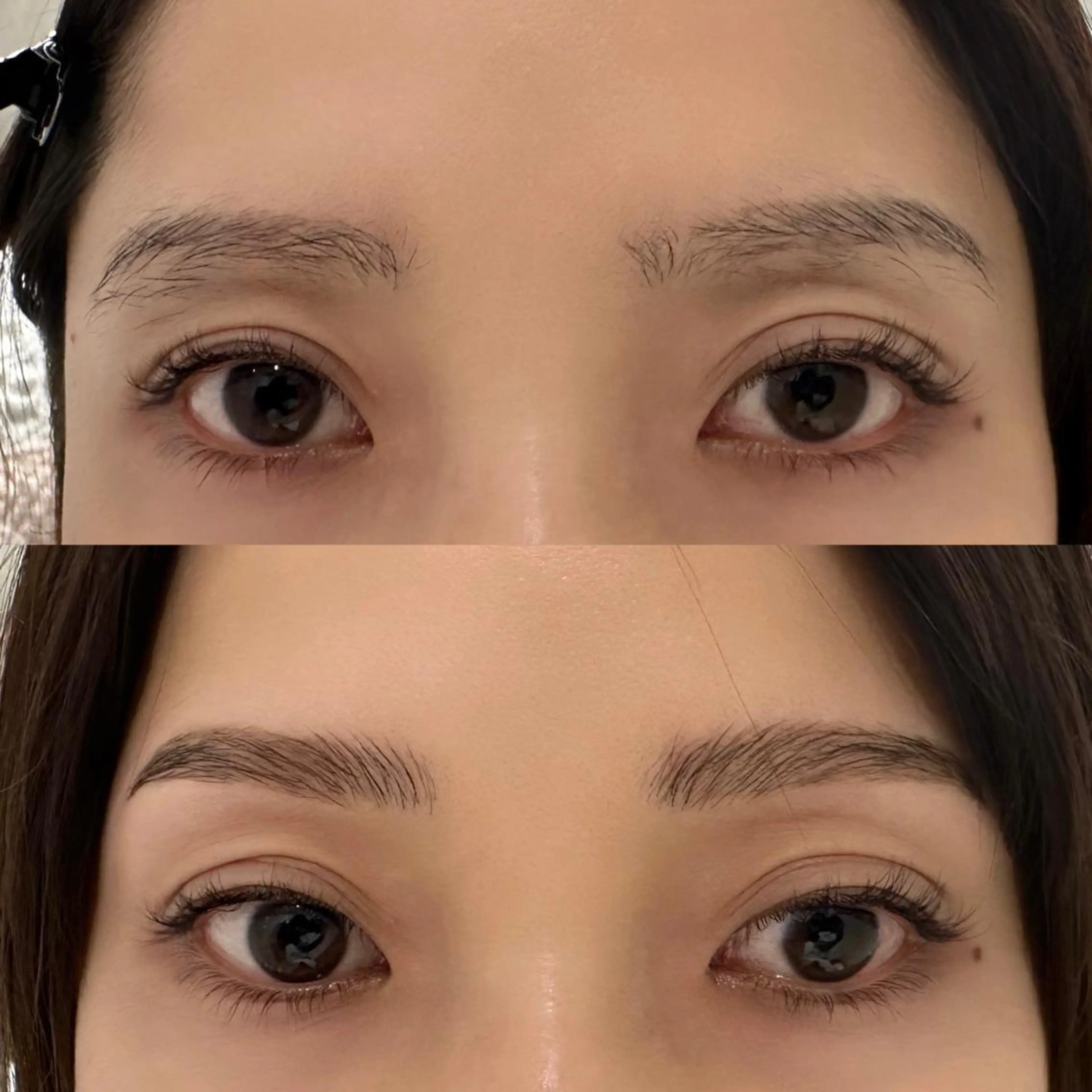 ブロウリフトの写真