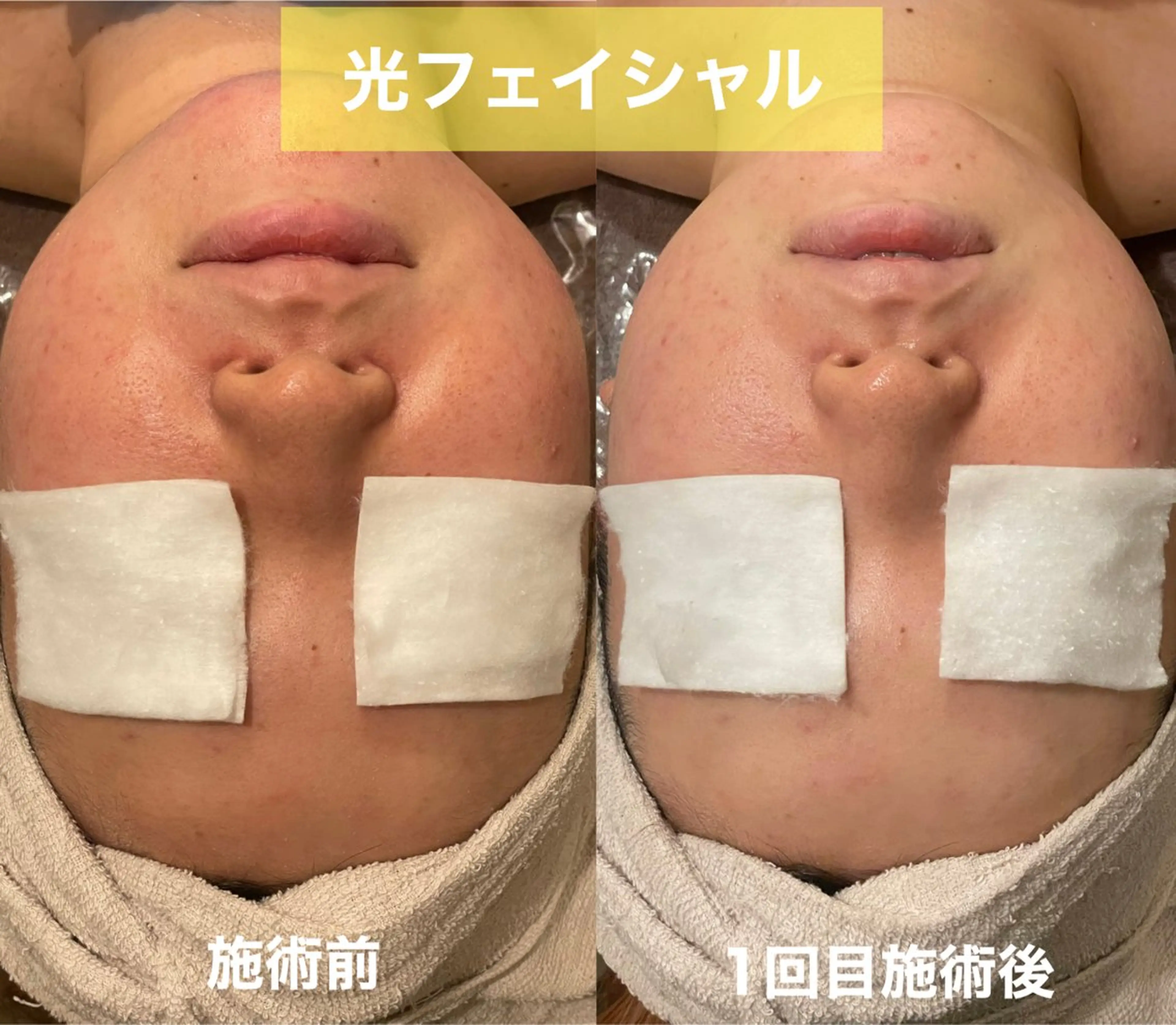 エステ 中尾 朱里のエステ・リラクイメージ