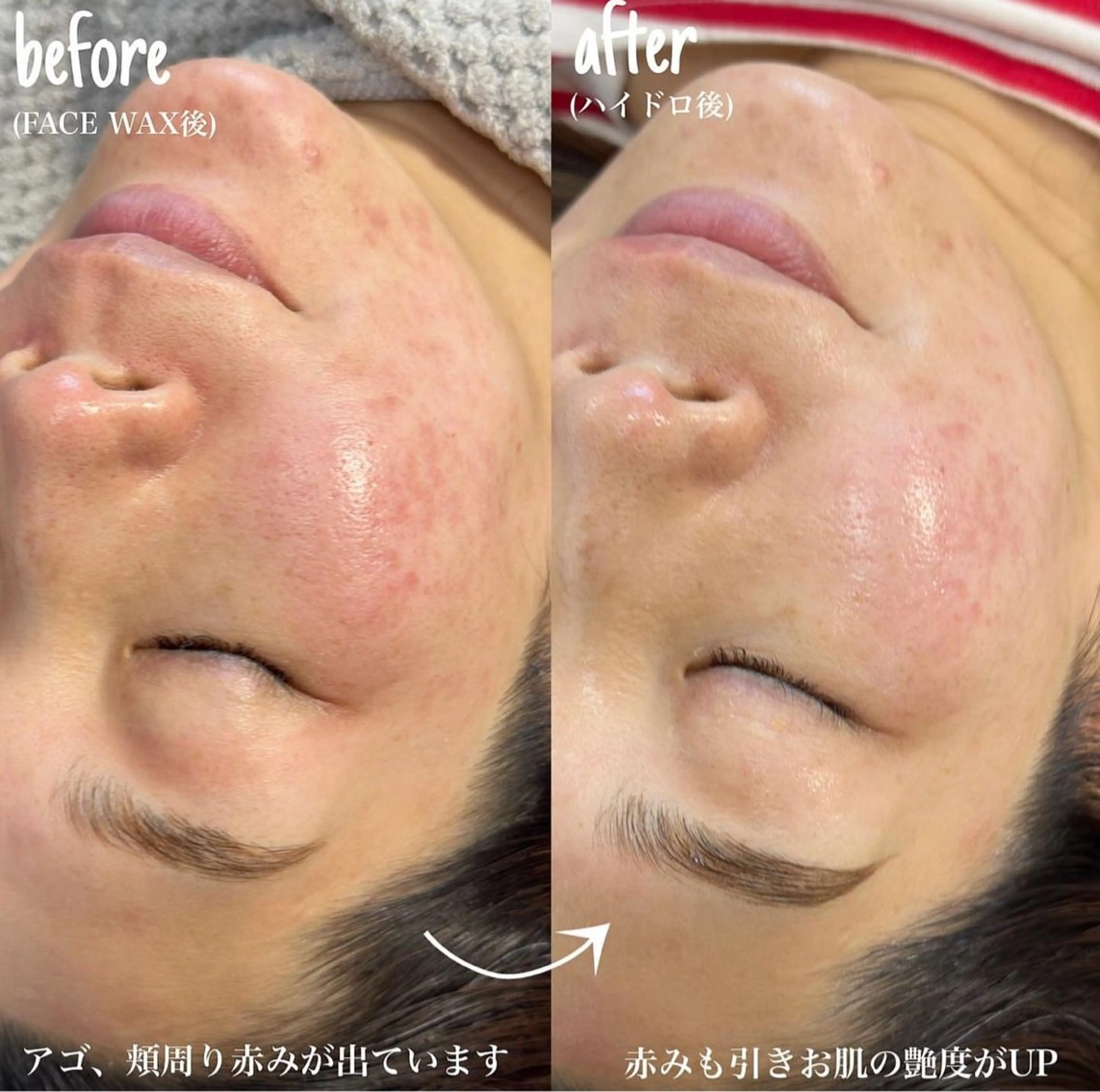 🪸HOLLYWOOD BROW LIFT+フェイスワックス 美眉艶肌の写真