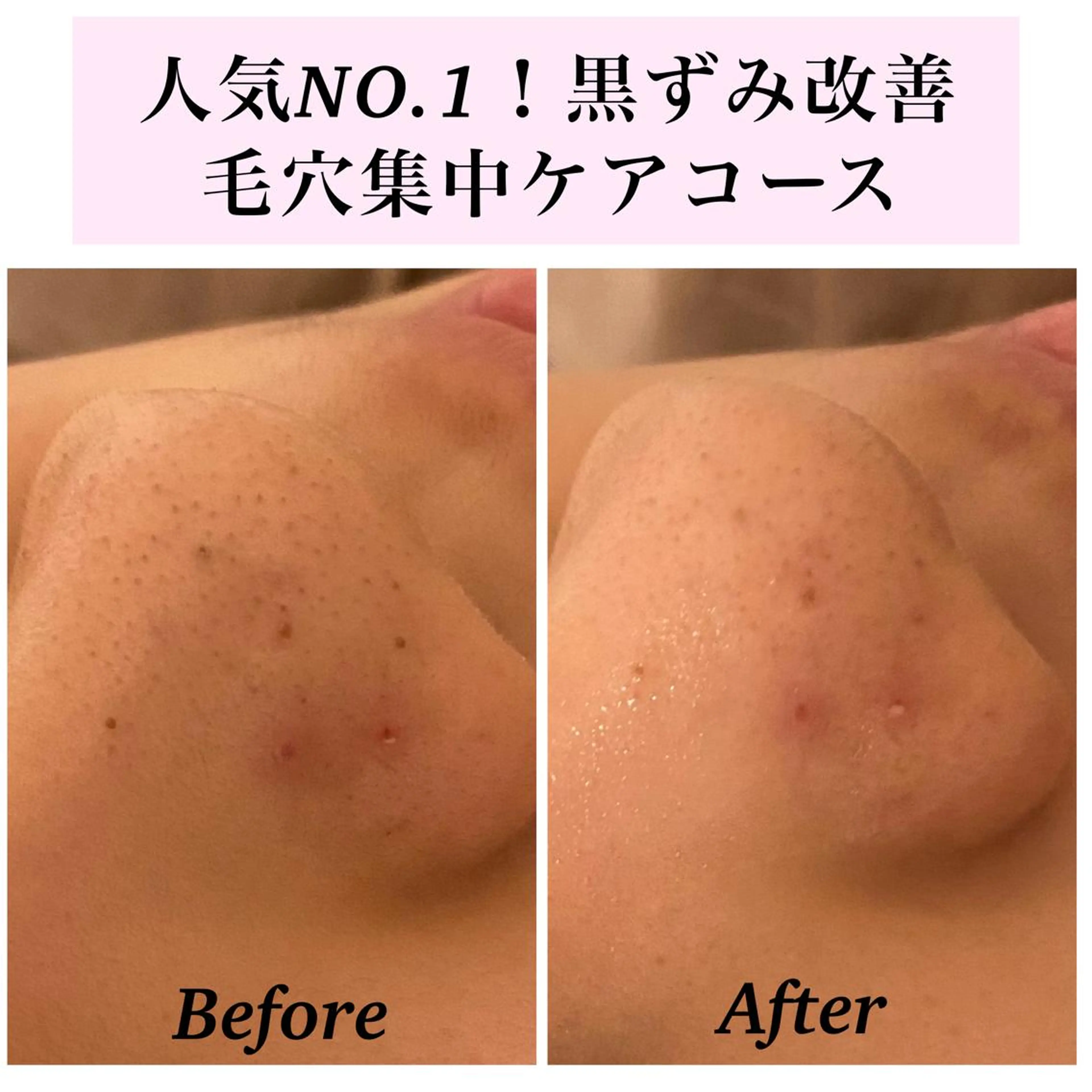 エステ リラク Bellesthe （ベルエステ）のエステ・リラクイメージ