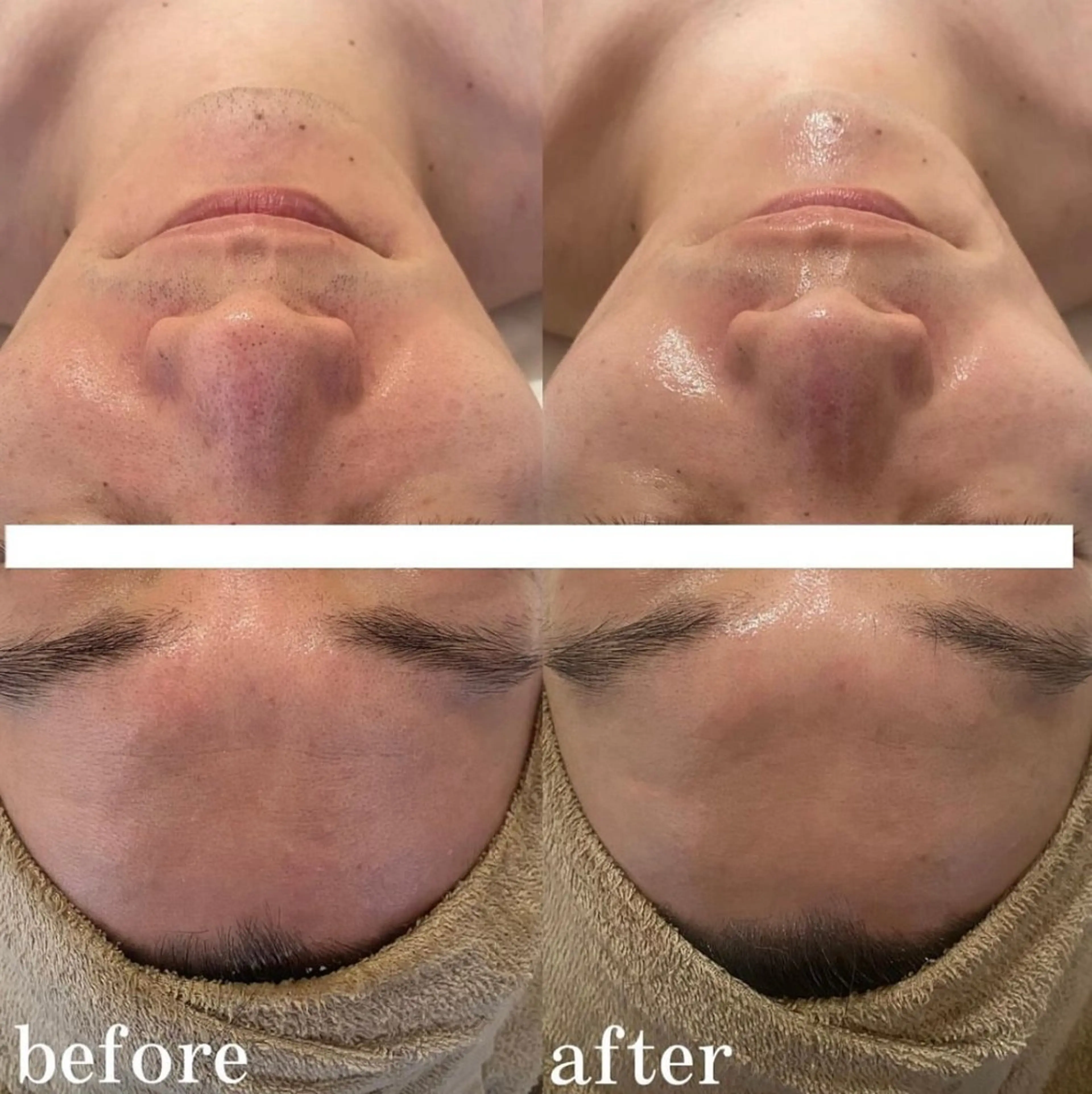 中目黒ハーブピーリン グ🌿ララピールのエステ・リラクイメージ