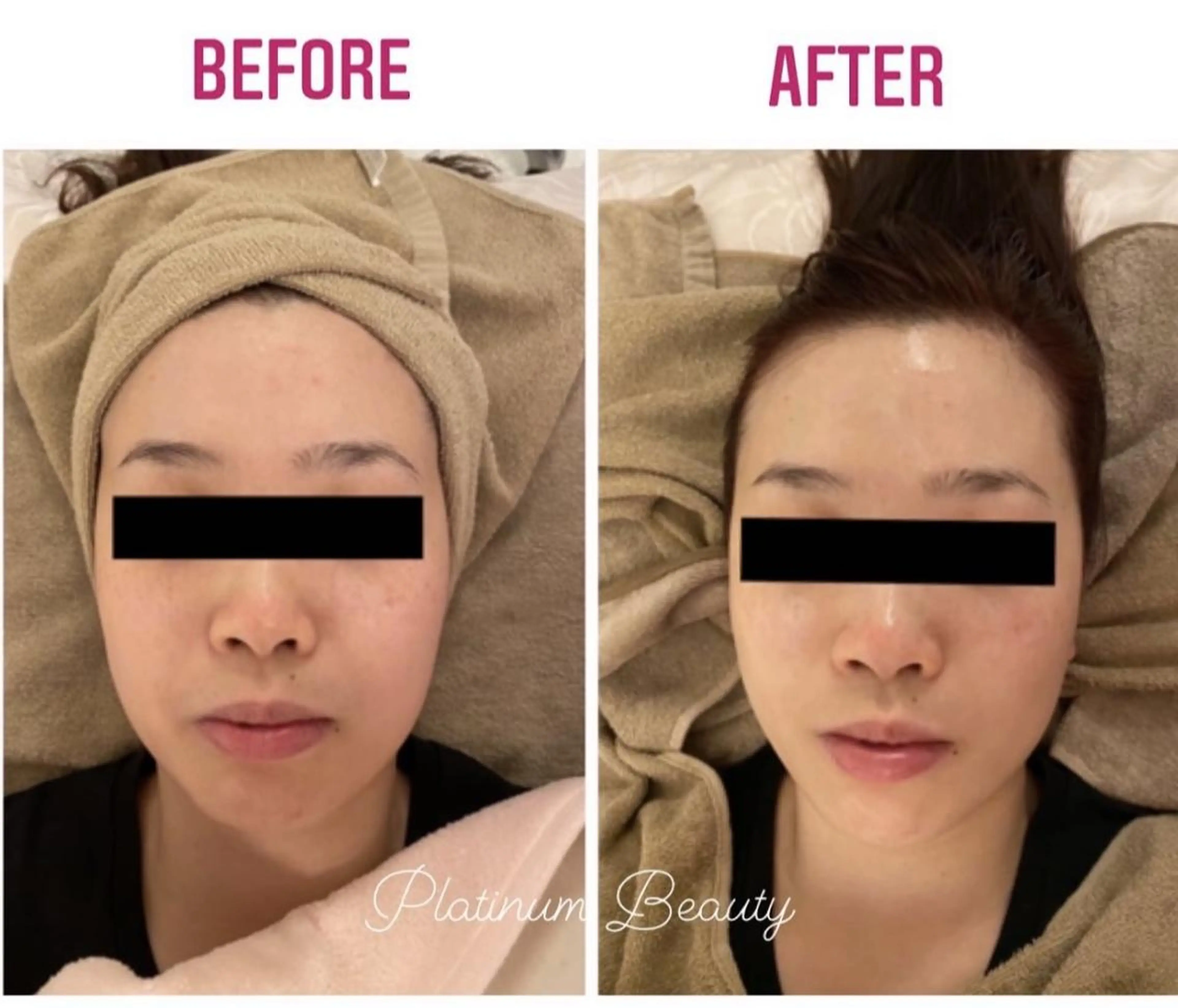 エステ プラティーヌ ボーテ【もものり】のその他イメージ