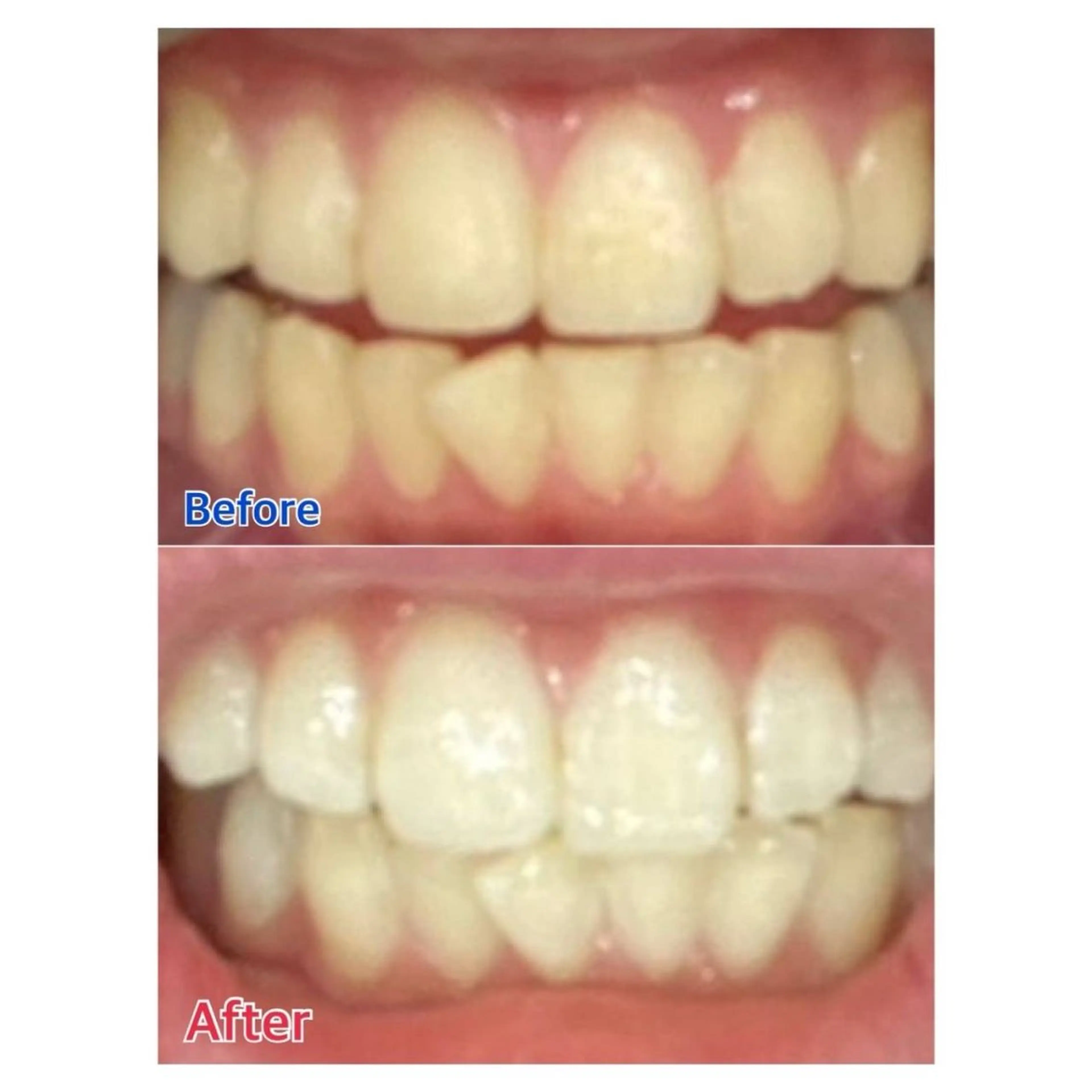 MBEAUTYSALON 千葉店・京成大久保所属・Melty 輝のその他イメージ