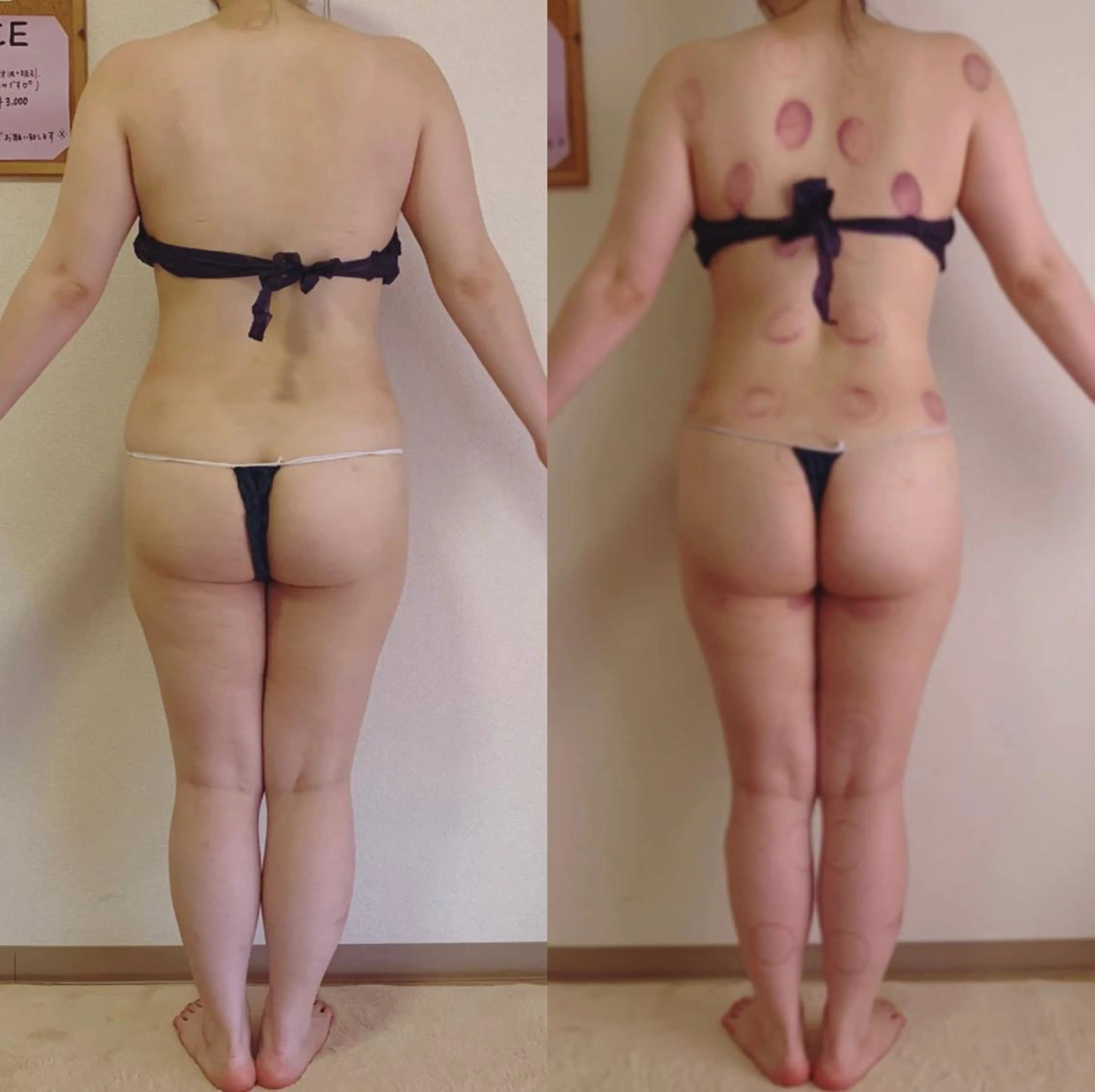 a  room salonのエステ・リラクイメージ