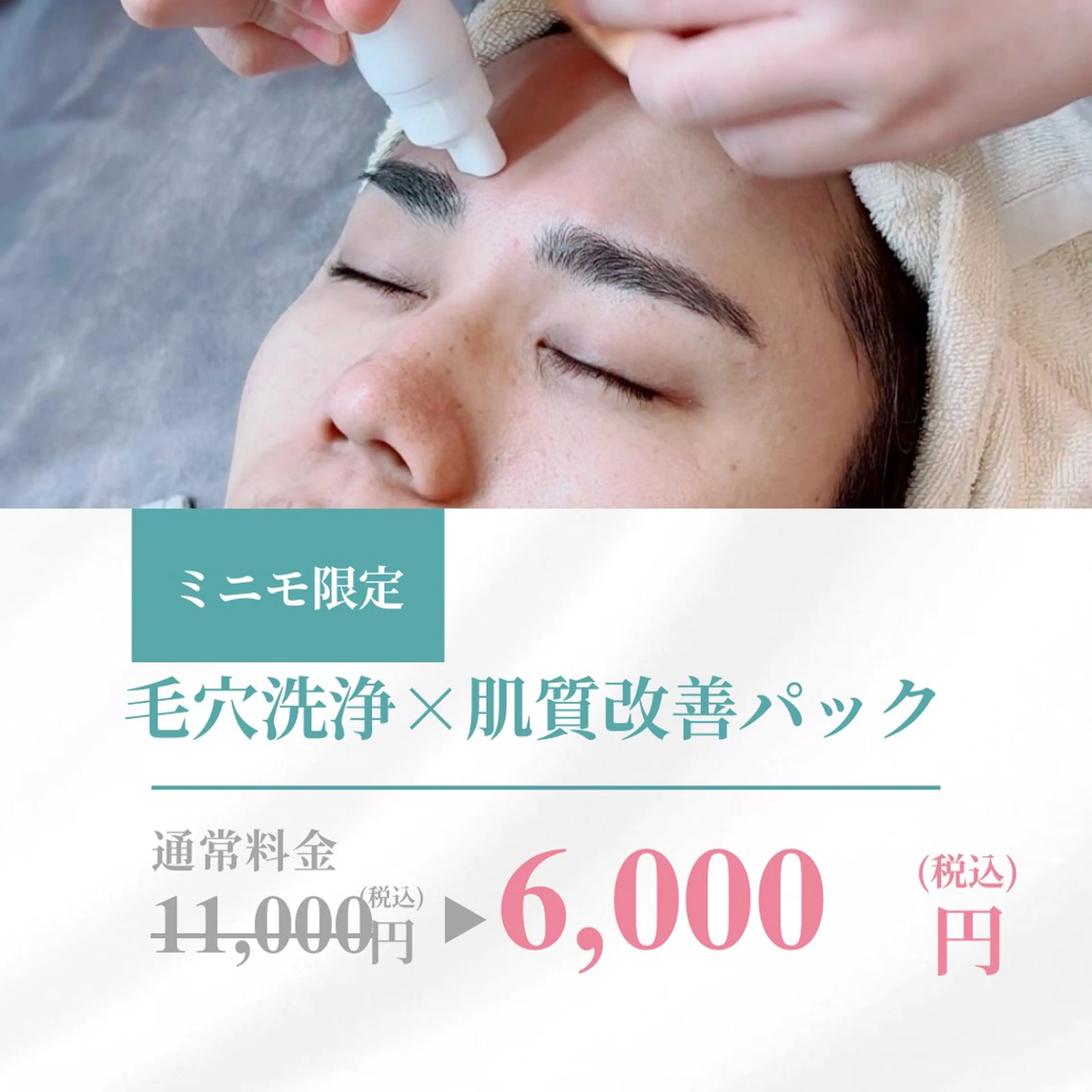 【ミニモ限定価格】 毛穴洗浄+選べる肌質改善パック✨6,000円(モニター価格)の写真