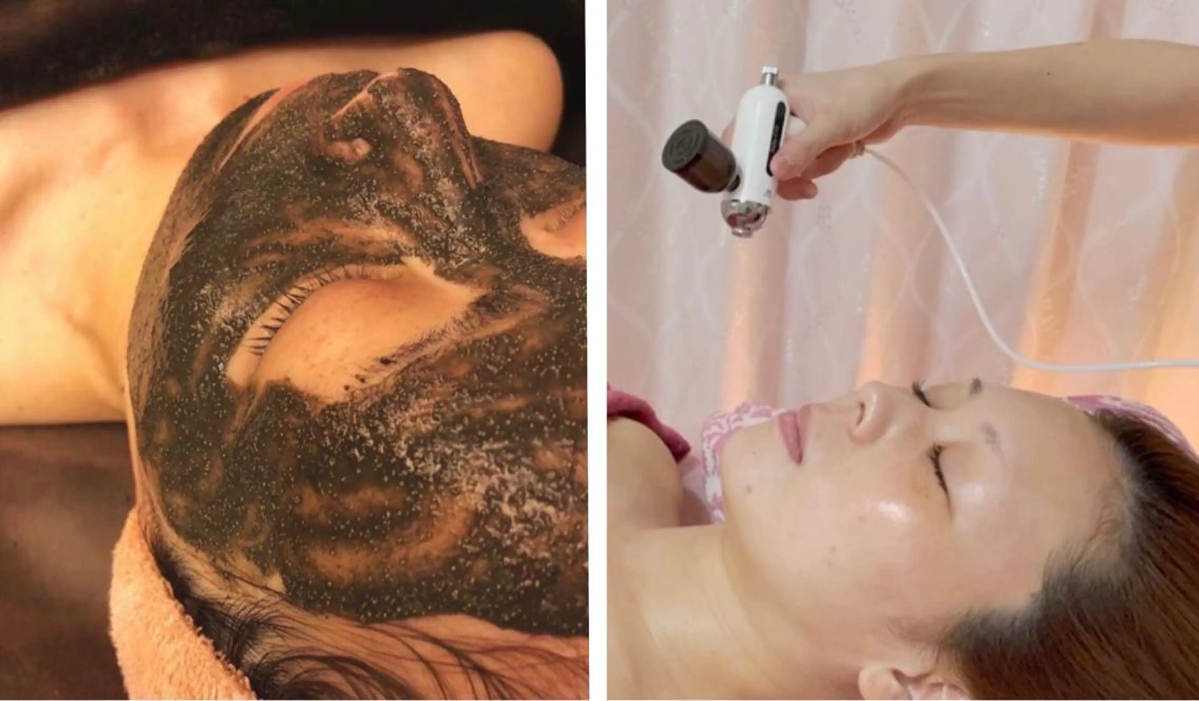 ベラージュ【美背中・ 美尻・フェイシャル】のエステ・リラクイメージ