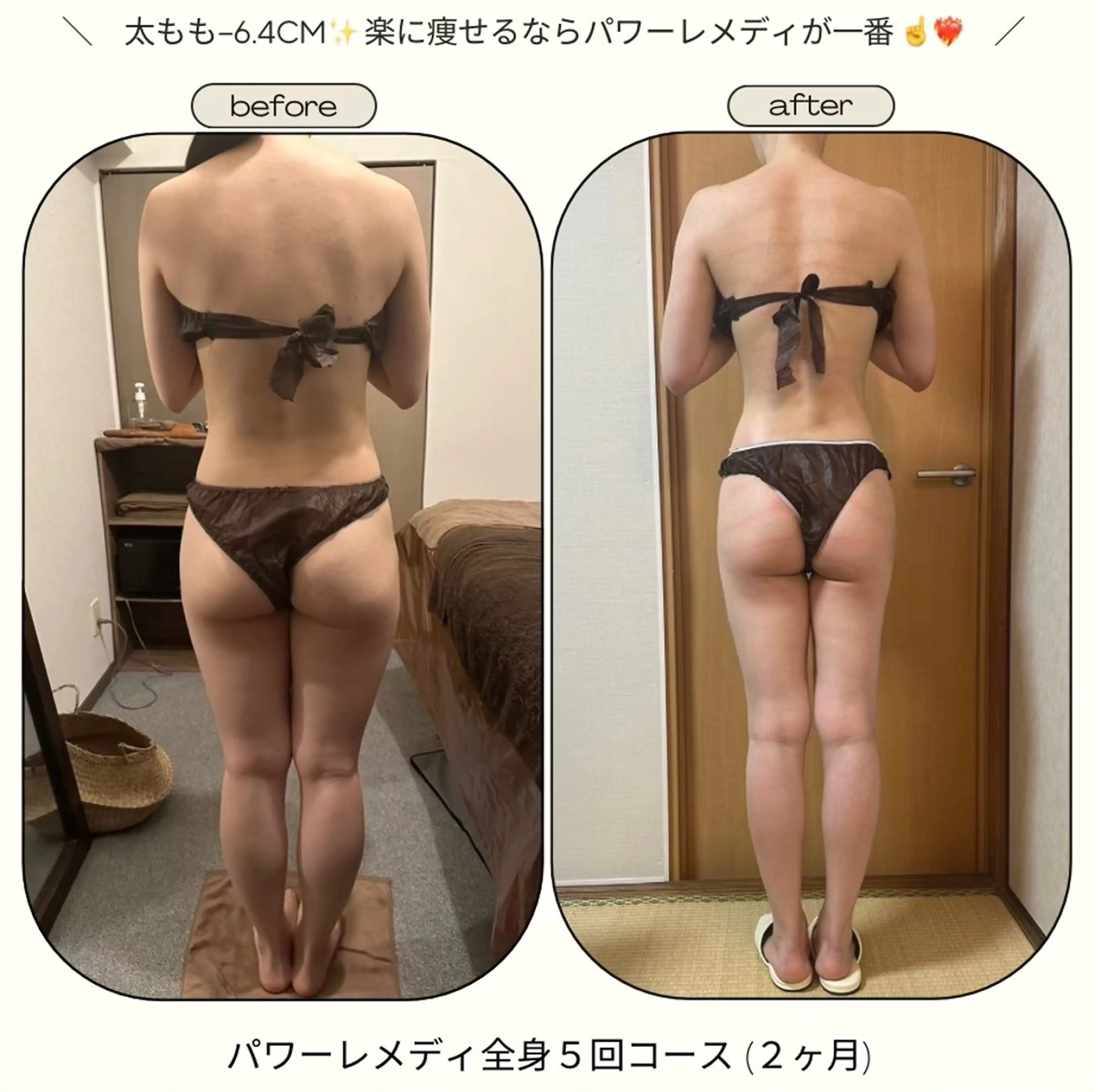 biloop所属・《本気痩せ×疲労改善 》  BILOOPのエステ・リラクイメージ