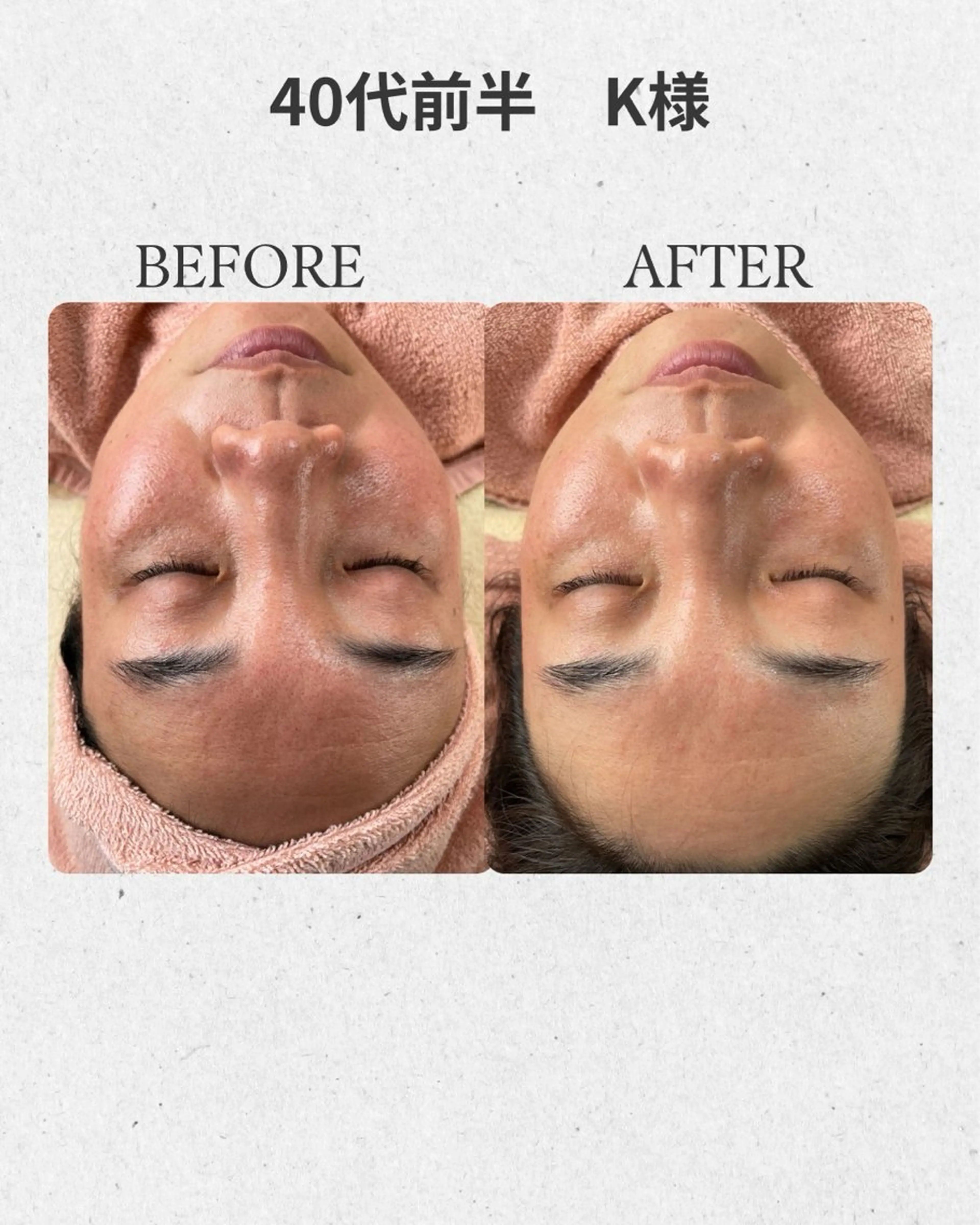 Salon  de LINON所属・Salon de  LINONのエステ・リラクイメージ