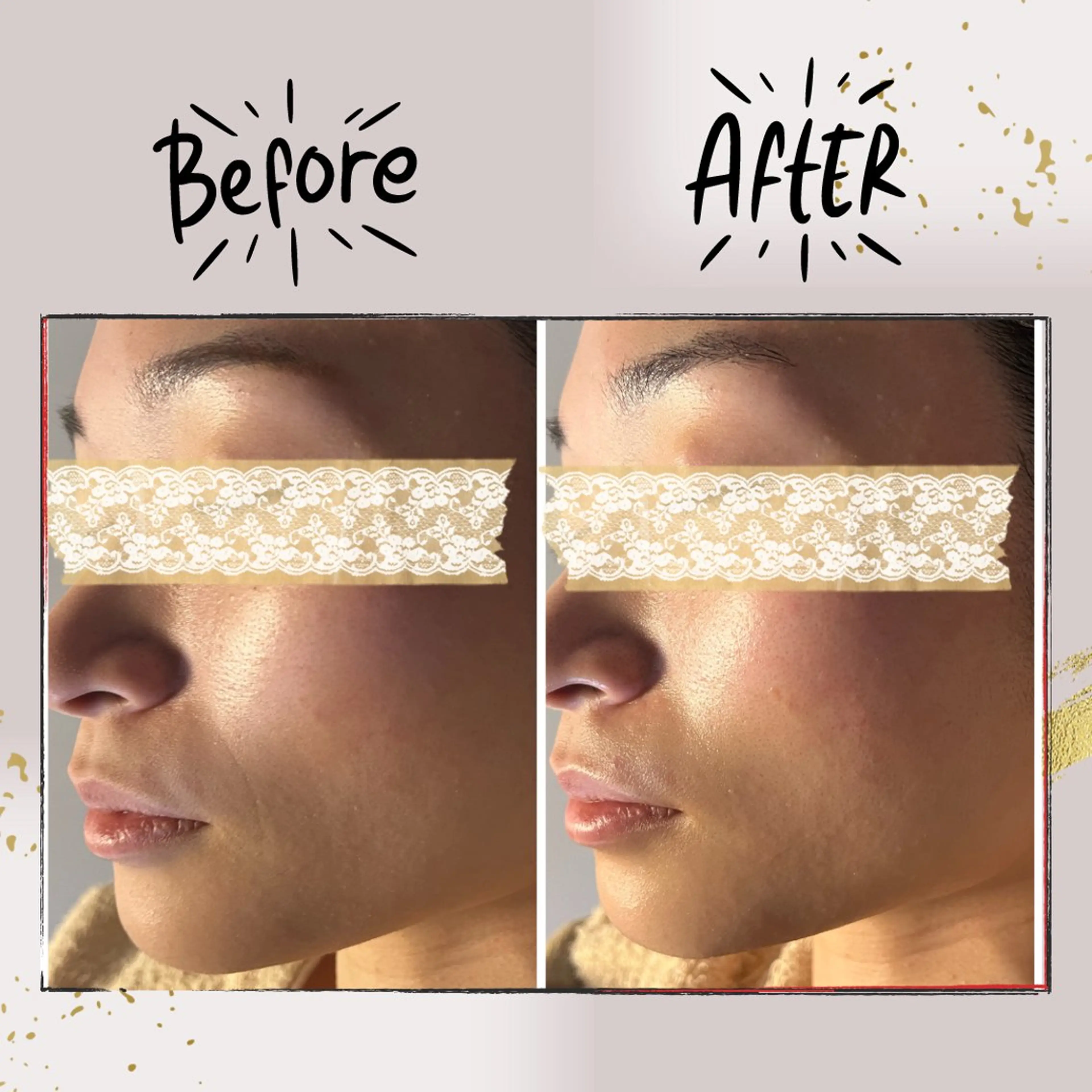 エステ ピーリング専門店 Belluteのエステ・リラクイメージ