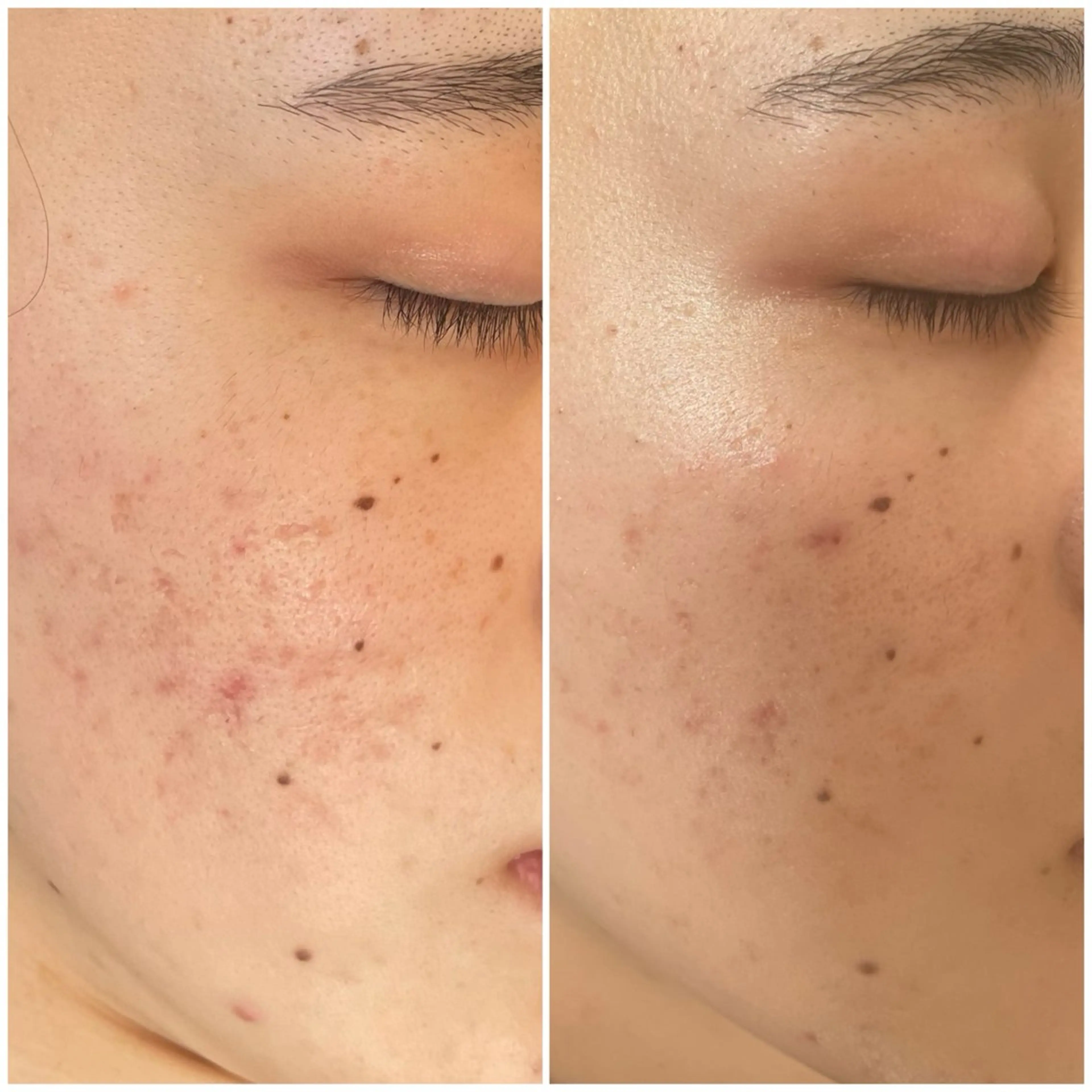 エステ フィユ所属・〚博多〛フィユ 水江のマツエク・マツパデザイン