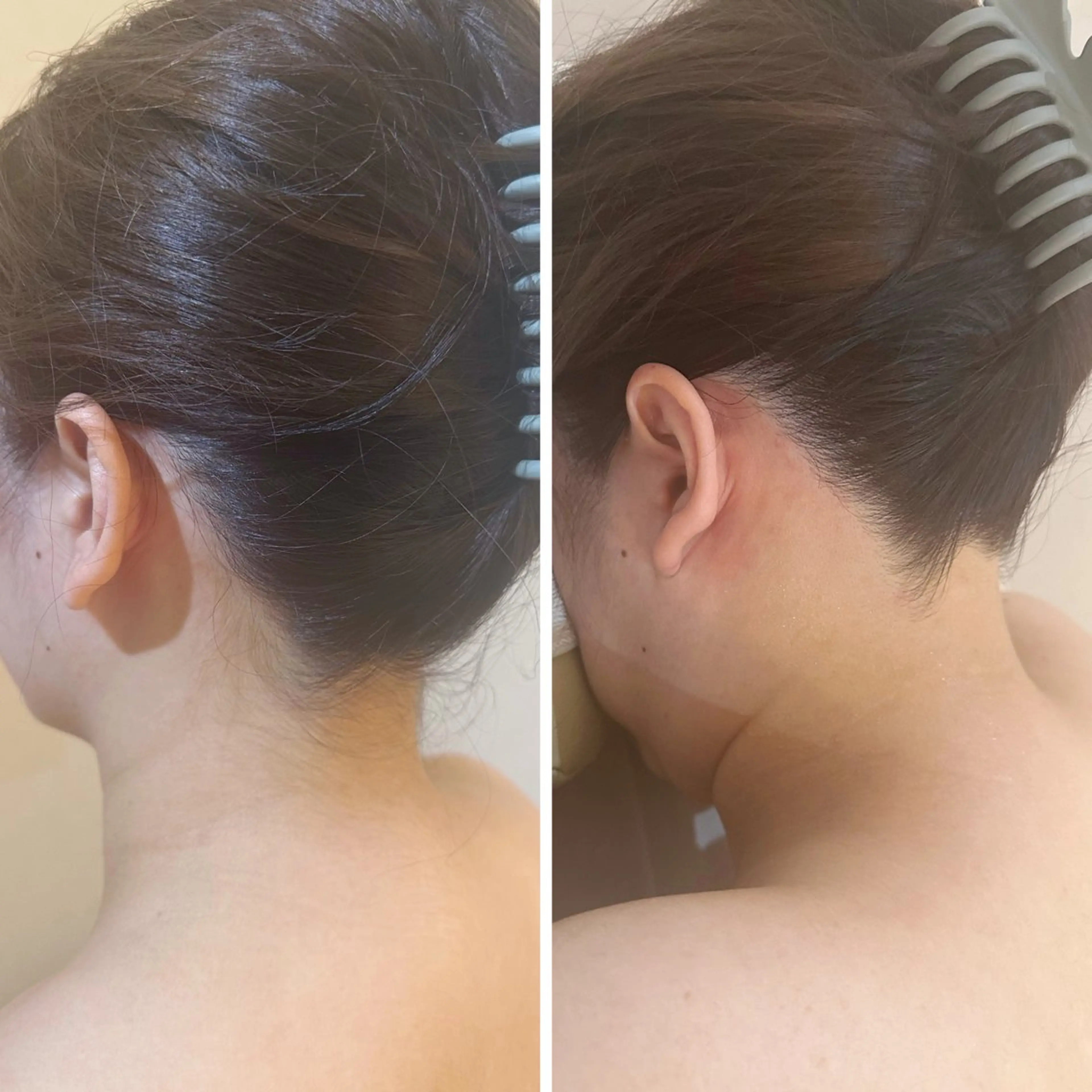 脱毛 うなじ脱毛/美肌脱毛 LABELのエステ・リラクイメージ