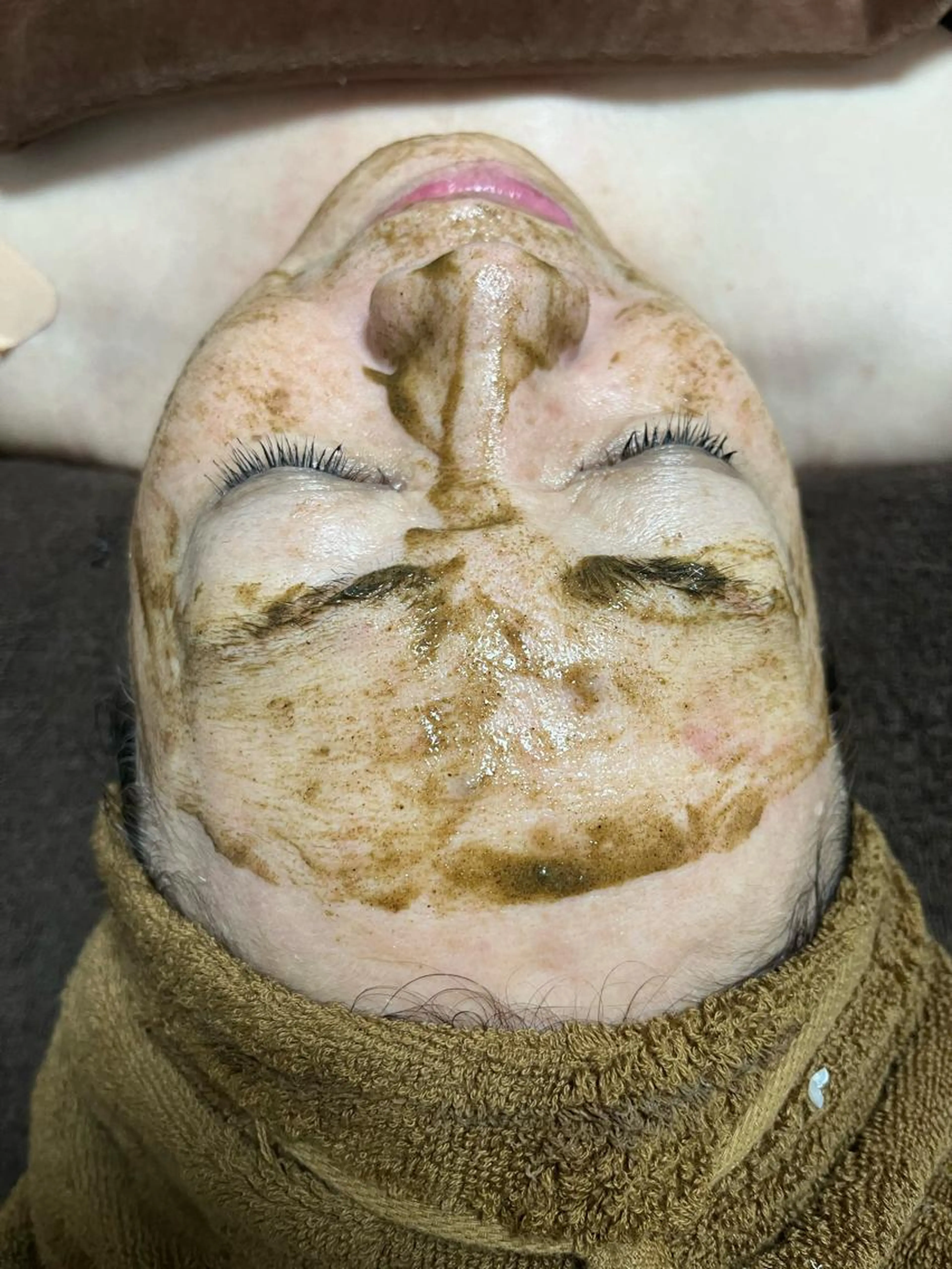 《肌のざらつき・毛穴が気になる方へ》ハーブピーリング＋デコルテマッサージ付の写真