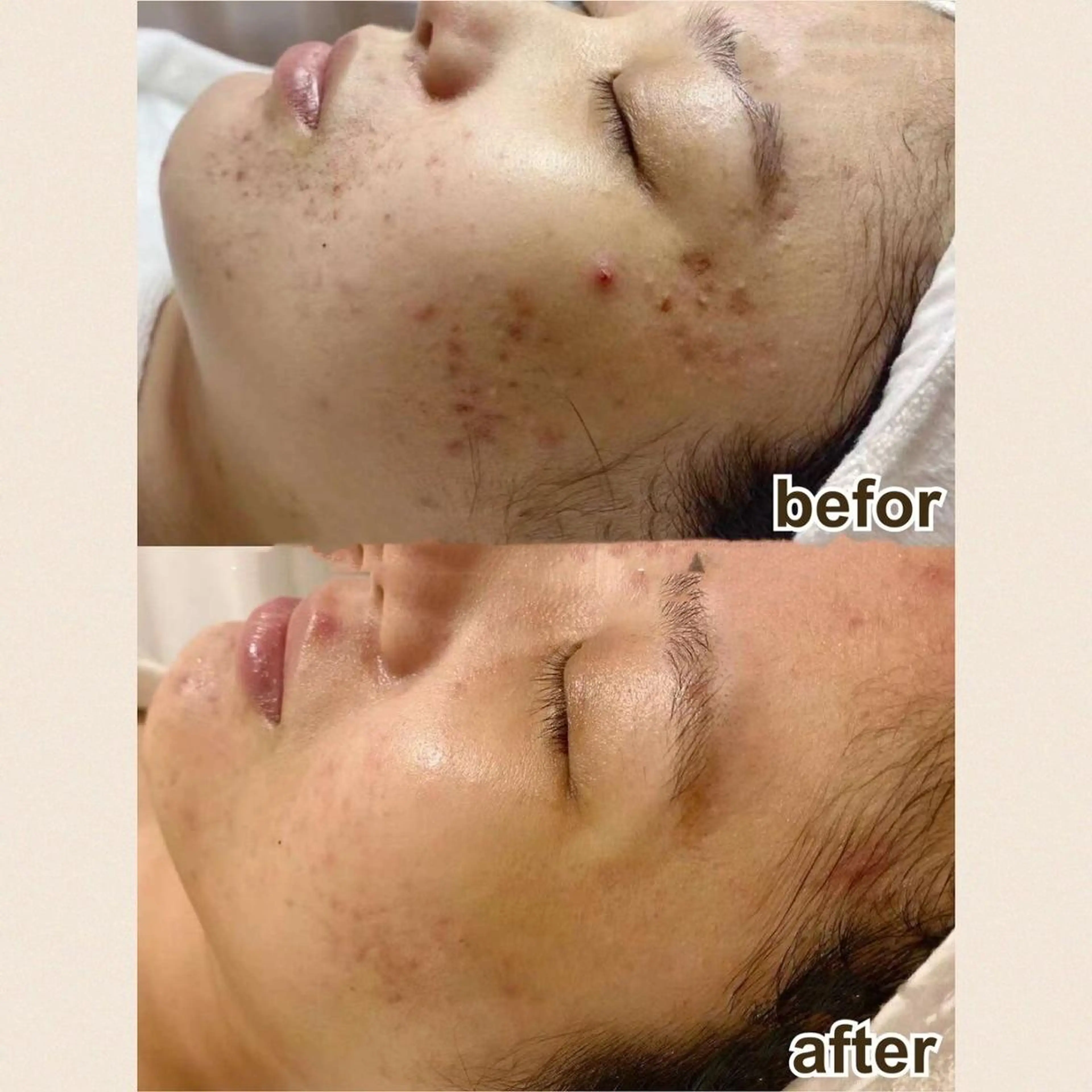 LingK/Este 駒田 辰玲のエステ・リラクイメージ