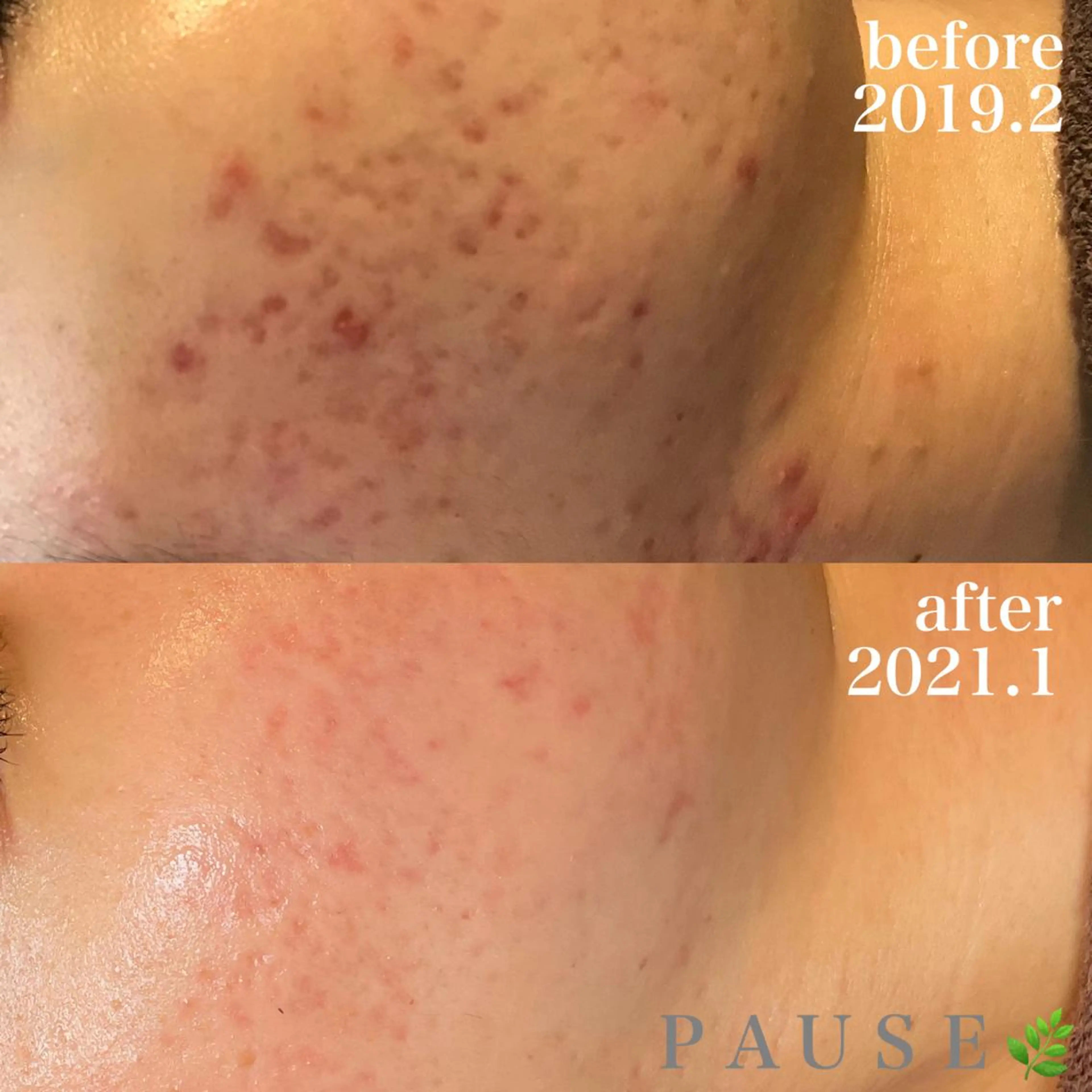 エステ 浜野 恵美のエステ・リラクイメージ