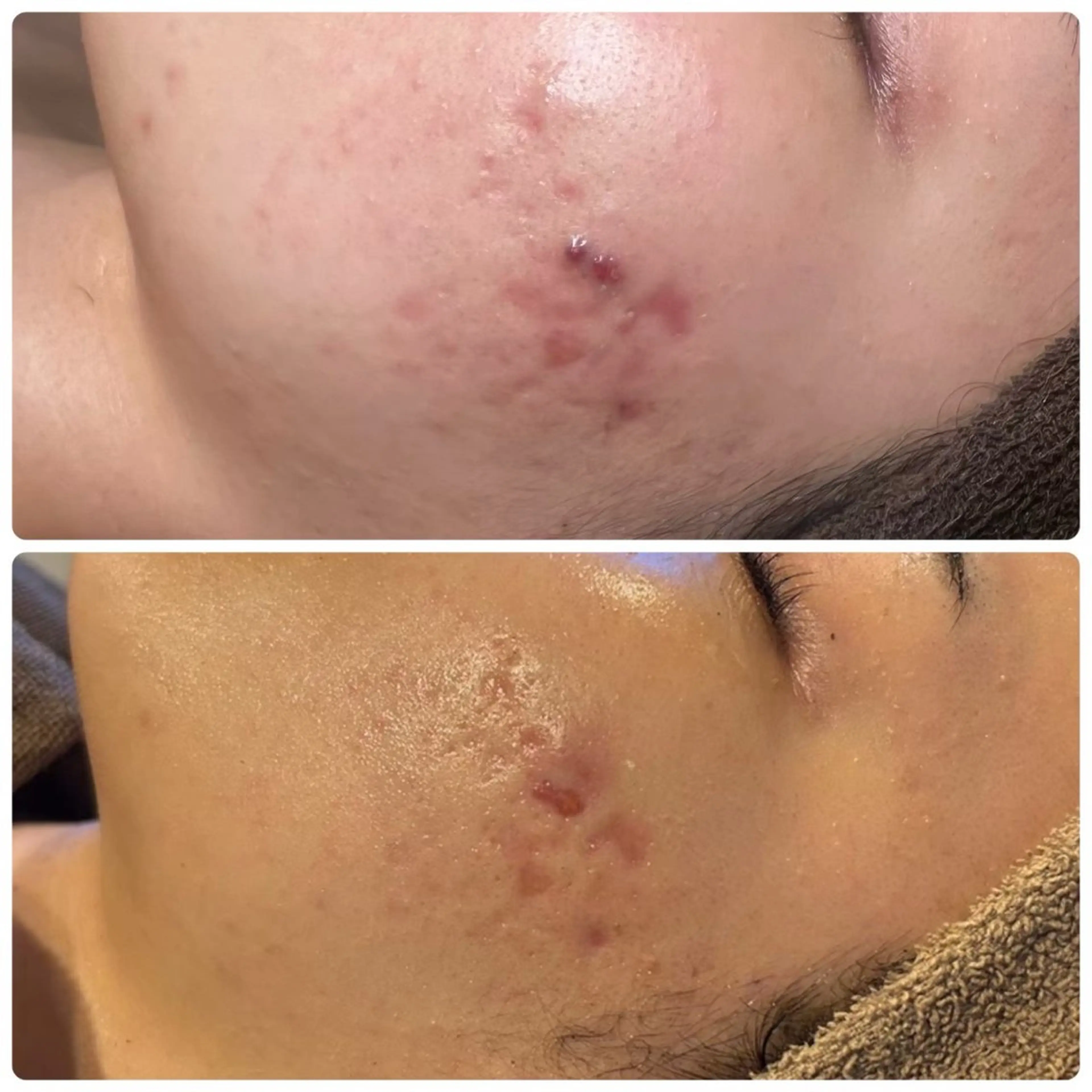 Cocofran/ manatsuのエステ・リラクイメージ