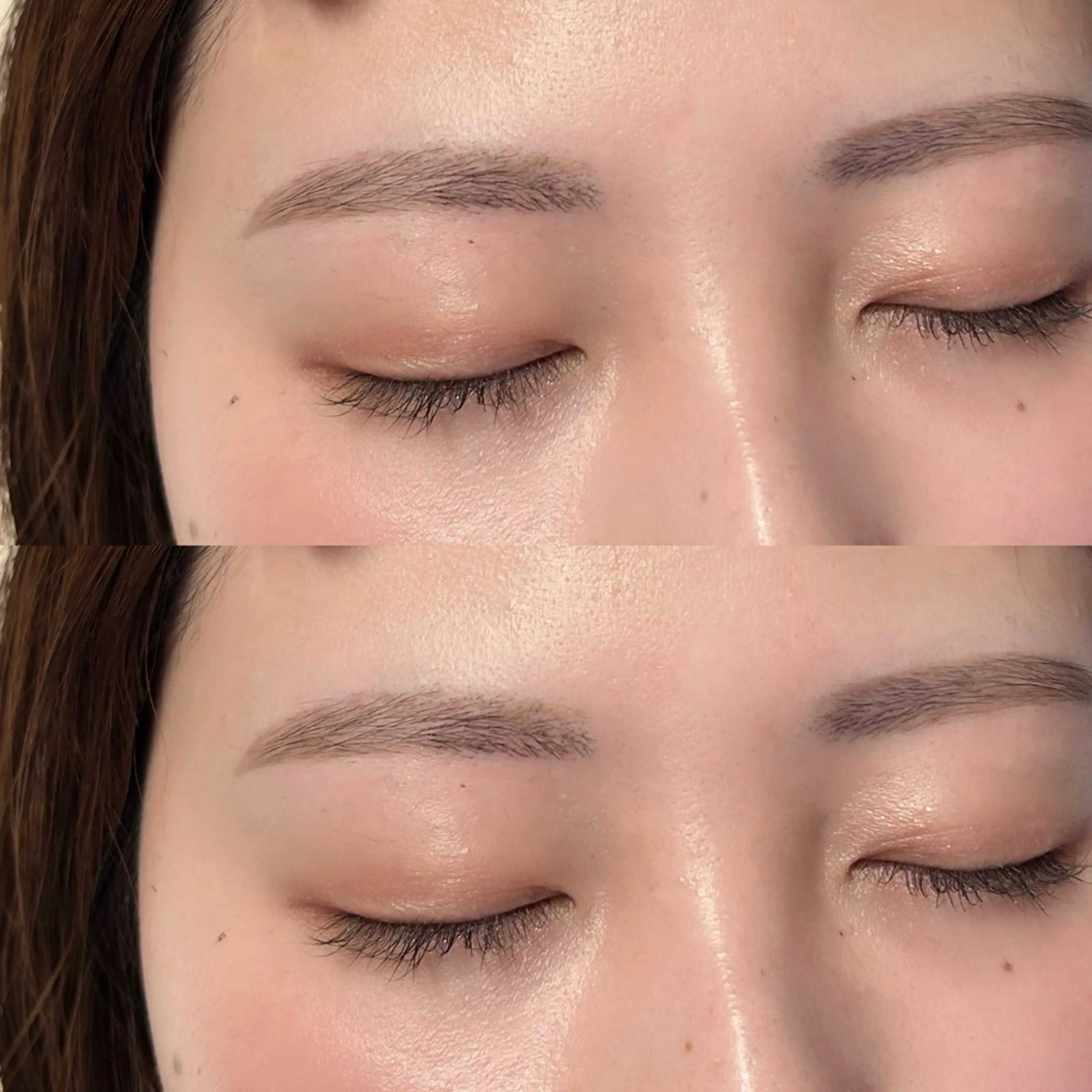 💎✨お顔丸ごと顔脱毛＋美眉スタイリング✨💎の写真