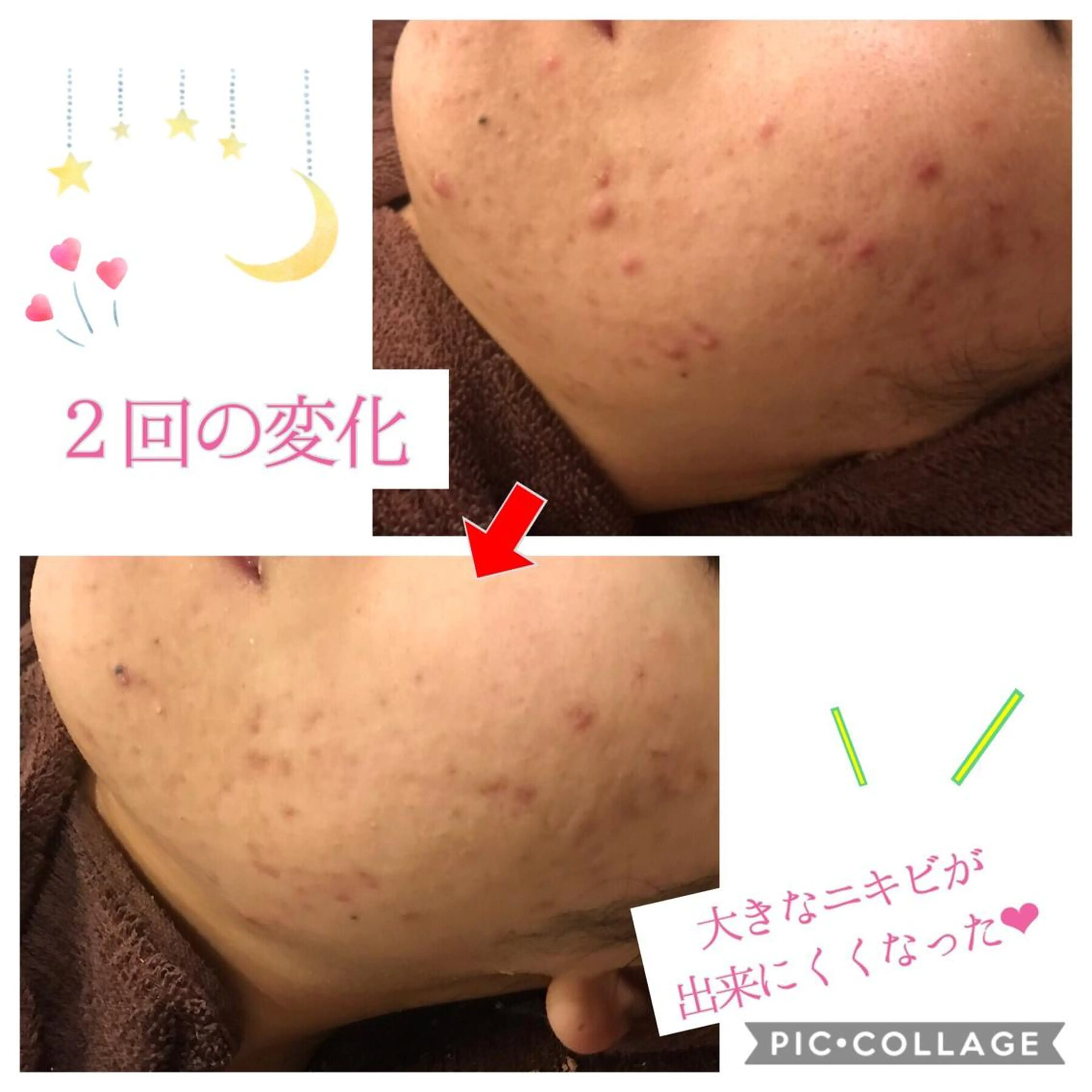 ミディアム カラー パーマ ヘアアレンジ メンズ キッズ ネイル マツエク・マツパ 四つ星サロン🎖 腸＆ニキビケアに特化のエステ・リラクイメージ