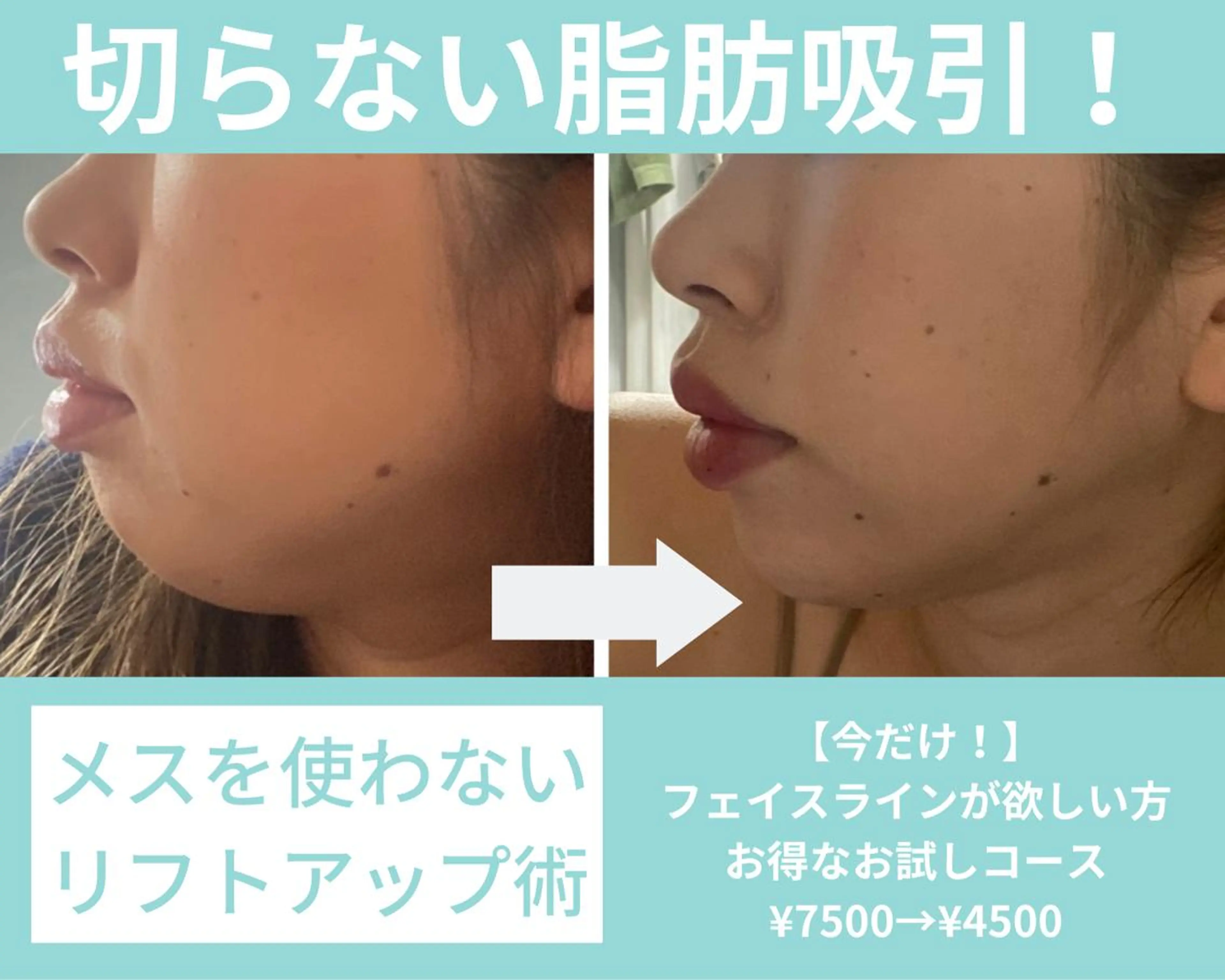 ハイフ&ドライヘッドスパ　SLIVIA所属・SLIVIA 毛穴洗浄&ヘッドスパのエステ・リラクイメージ