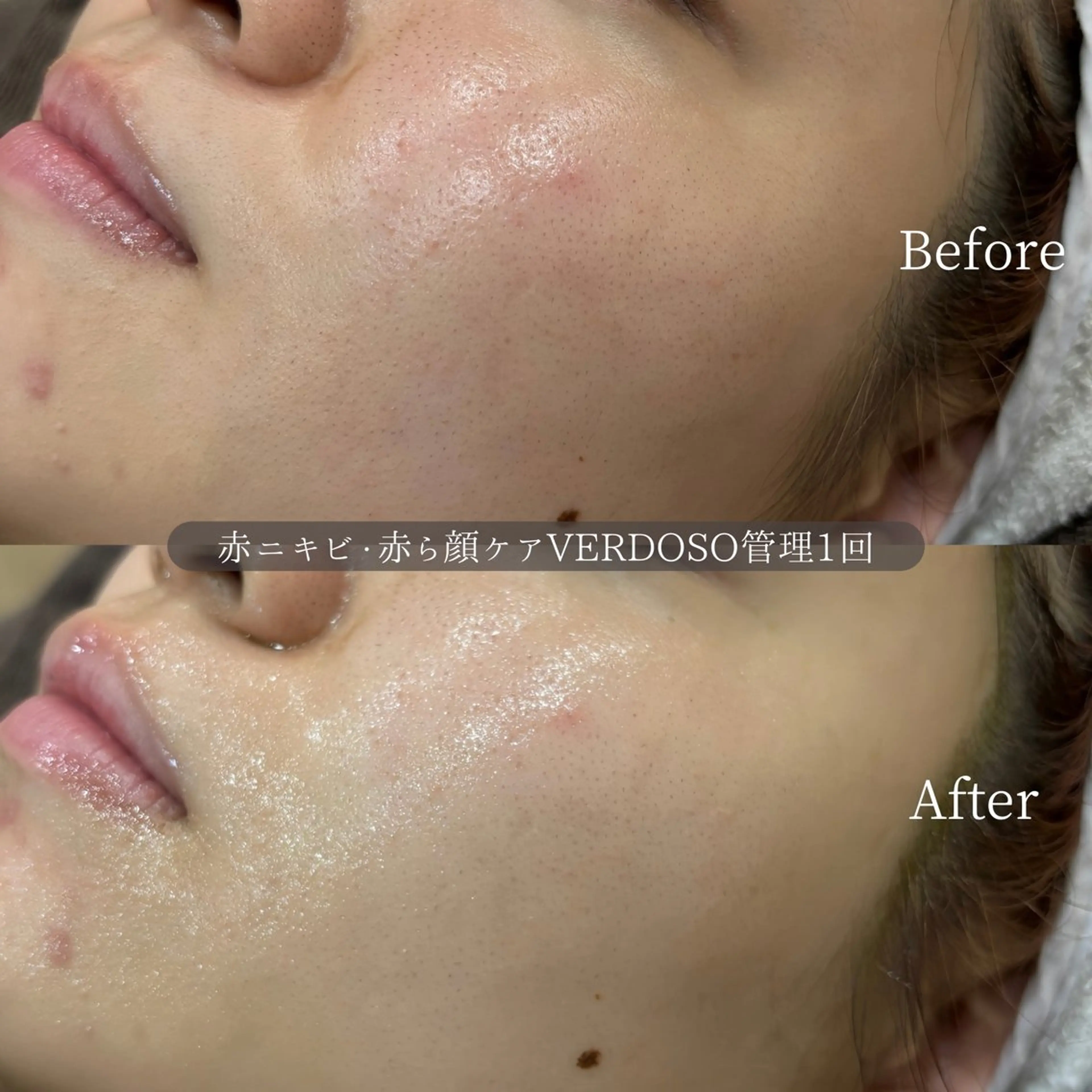 韓国風eyelush 眉毛サロン/Suuの眉毛・アイブロウイメージ