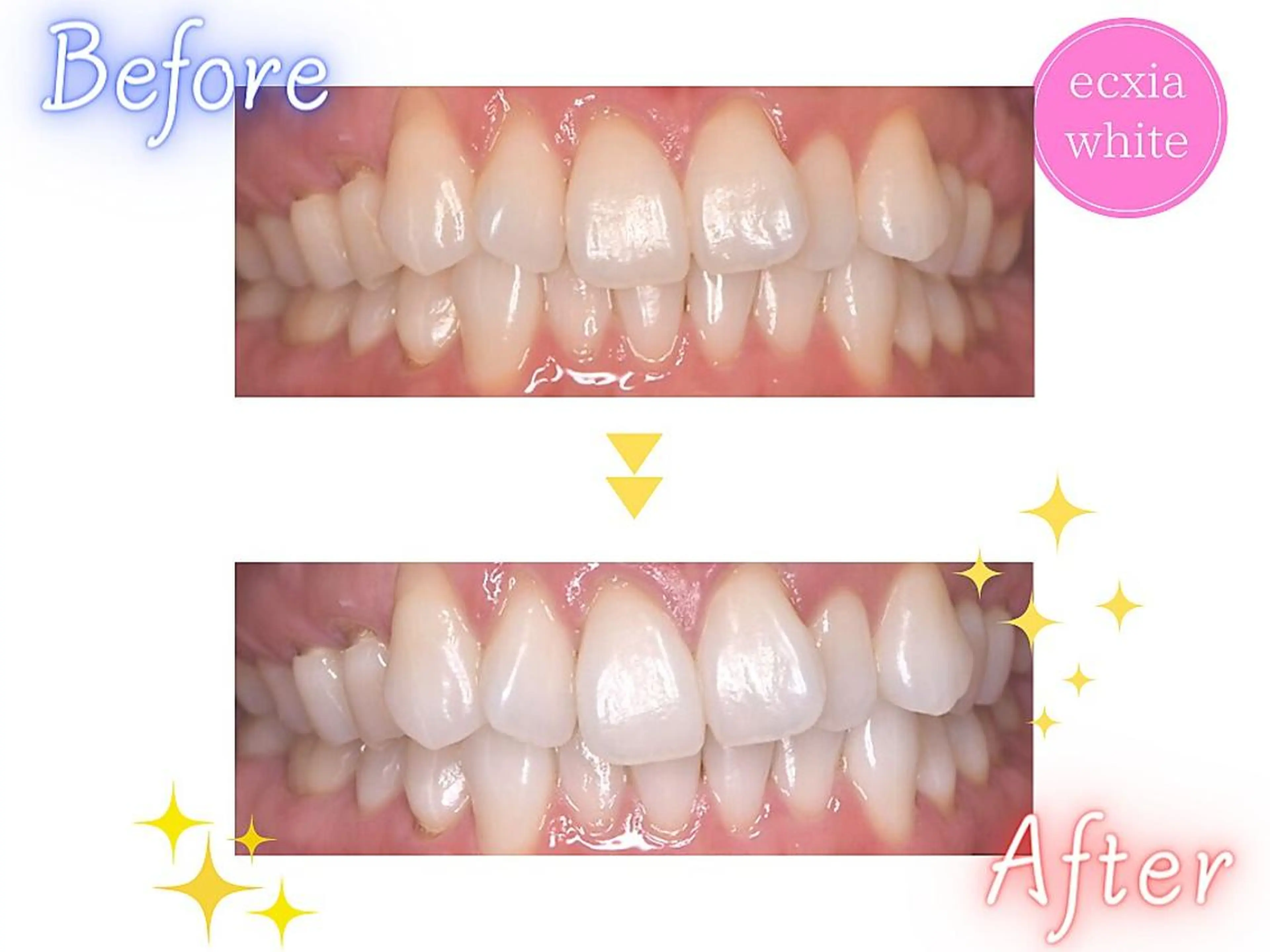 その他 セルフホワイトニング エクシア新百合ヶ丘店のその他イメージ