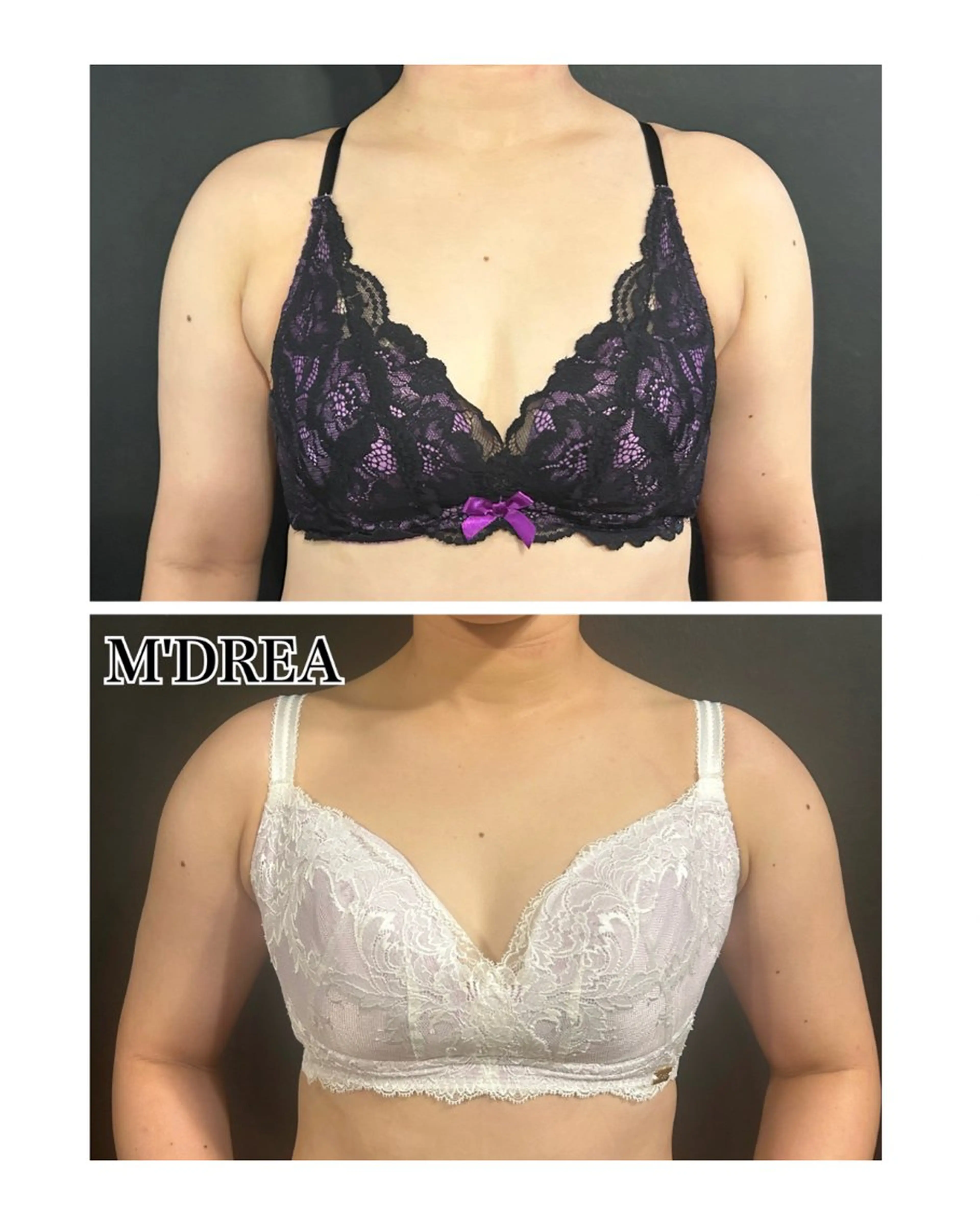 お背中二の腕痩身→M'DREAブラフィッティングの写真