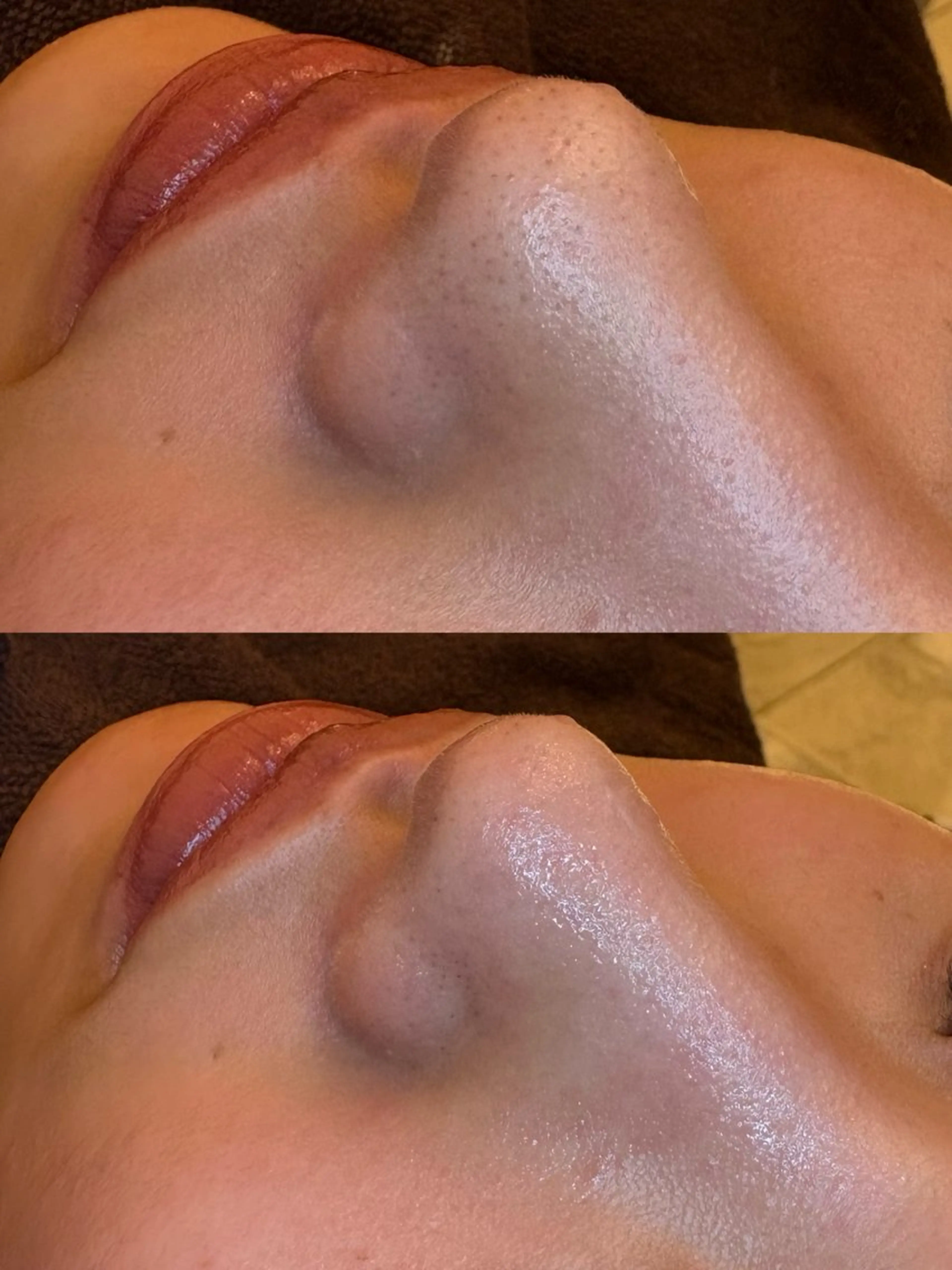 エステ EARTH coiffure beaute 新潟紫竹山店所属・🤍アベシュリ /フェイシャル🤍のエステ・リラクイメージ