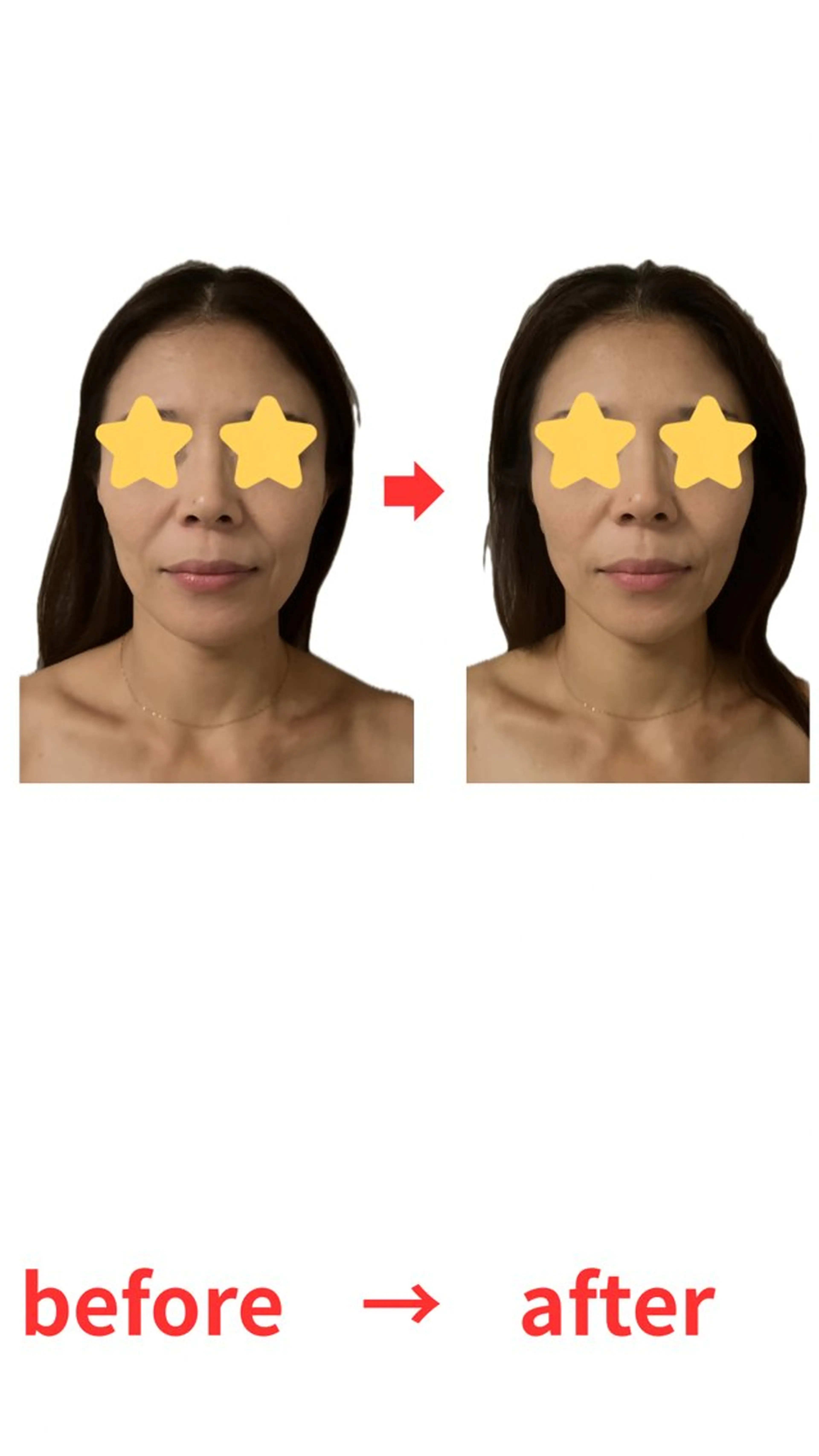 小顔＋遠赤外線ドーム(頭・顔・首・背中・腰・デコルテ施術)(ミネラルクリーム使用)の写真