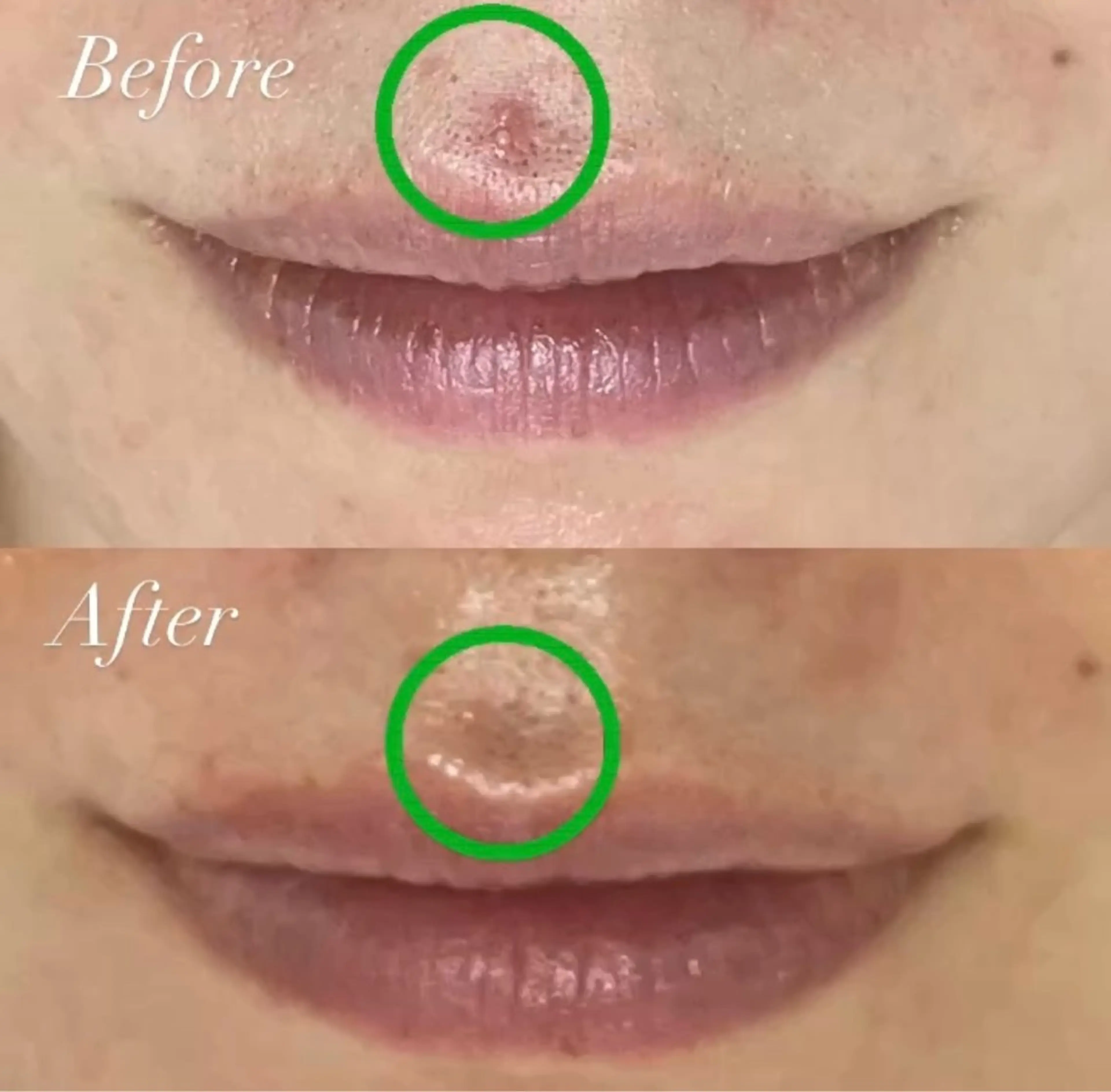 エステ プライベートサロン Belle（ベル）のエステ・リラクイメージ