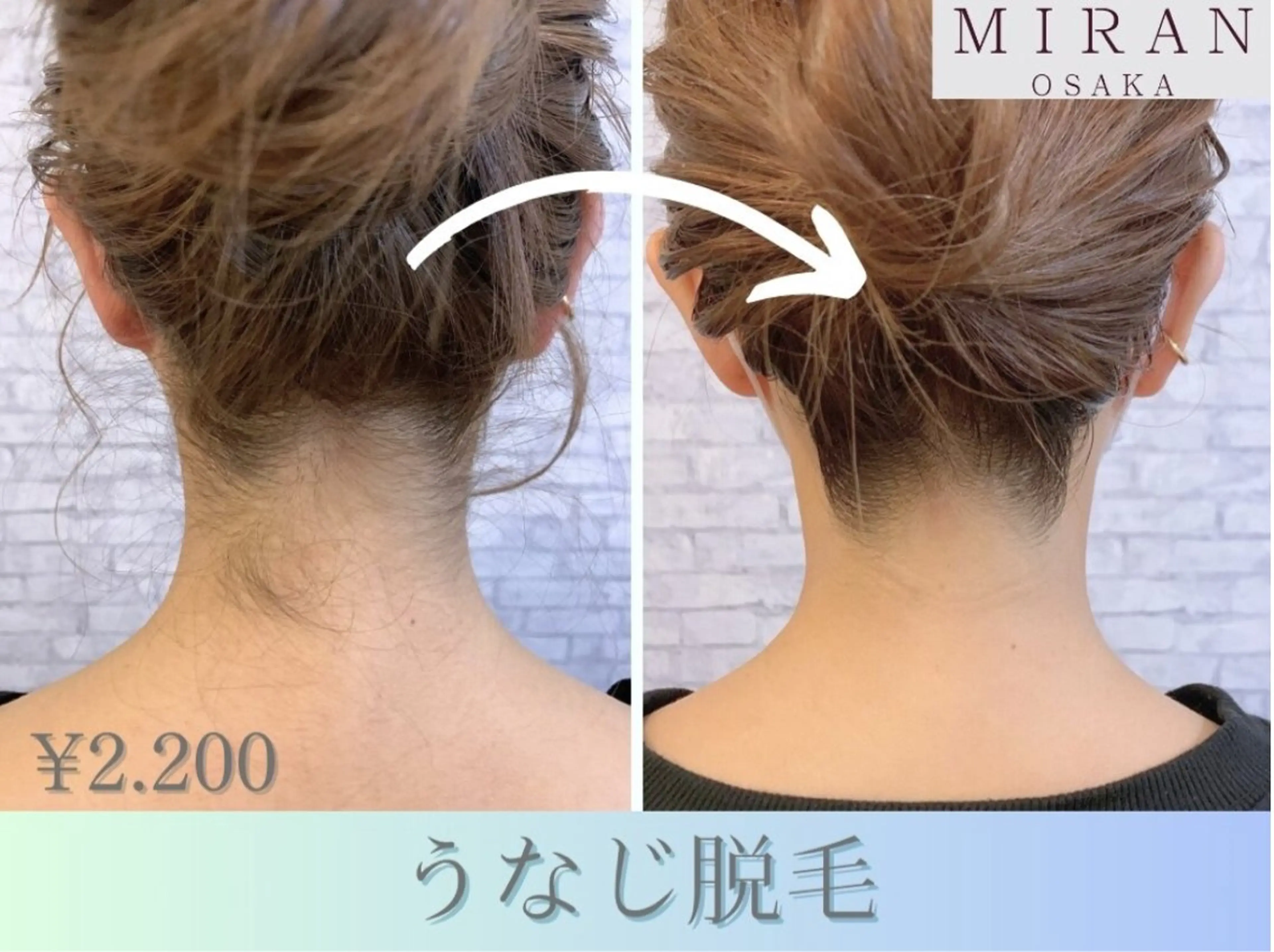 ☆男女OK☆うなじ脱毛☆シェービング、保湿付き☆￥2200の写真