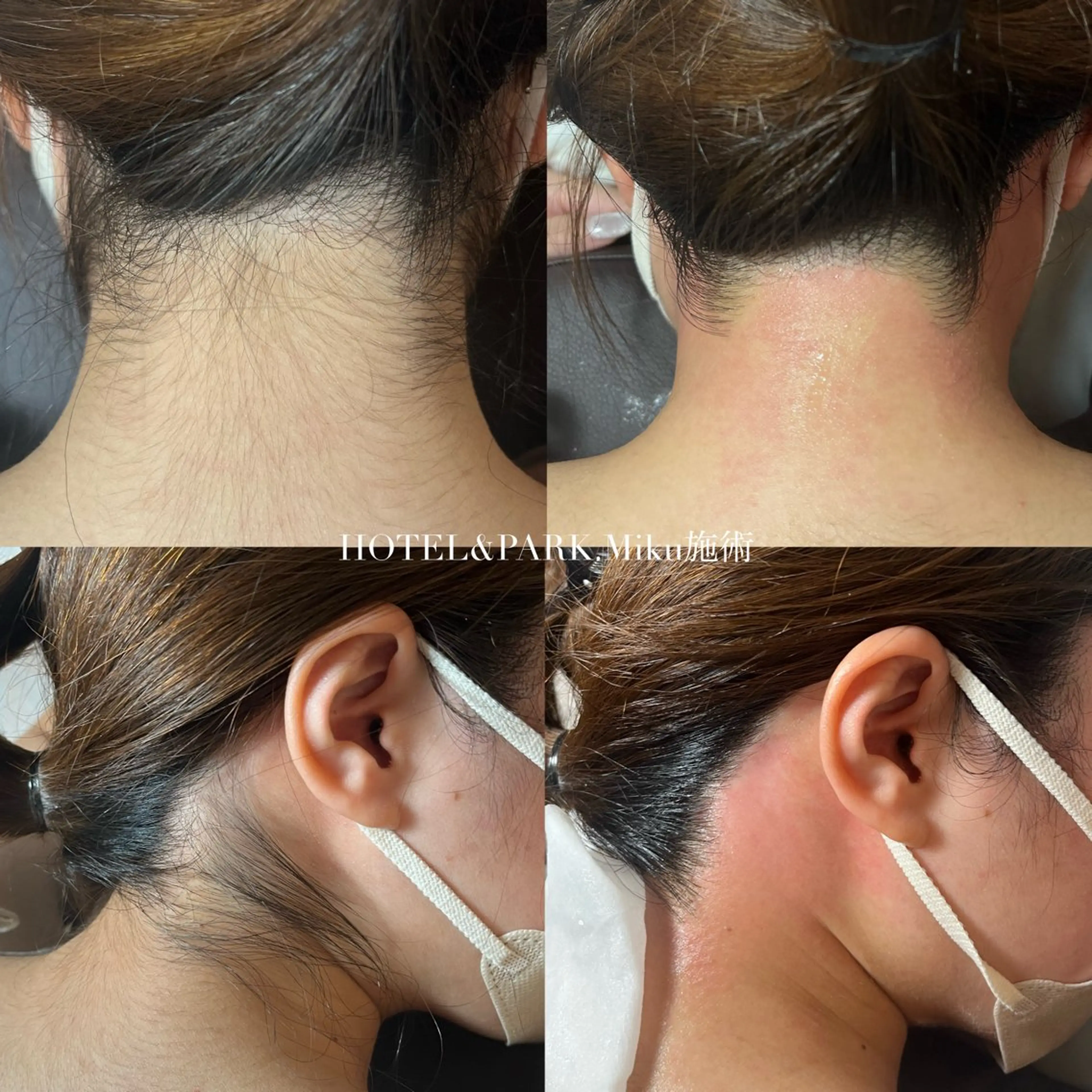 HOTEL&PARK Mikuワックス脱毛のエステ・リラクイメージ