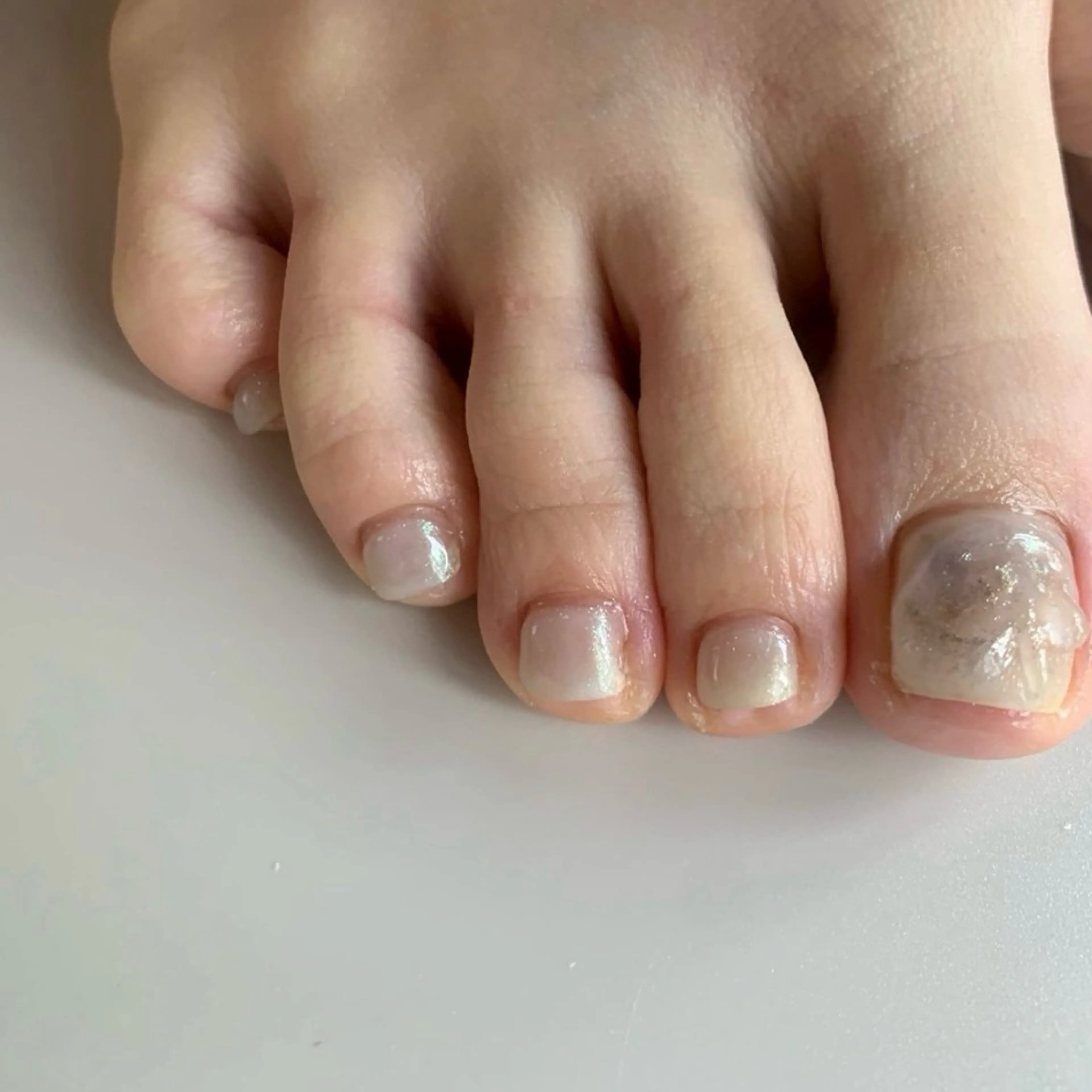 フット２本art（オフなし）の写真