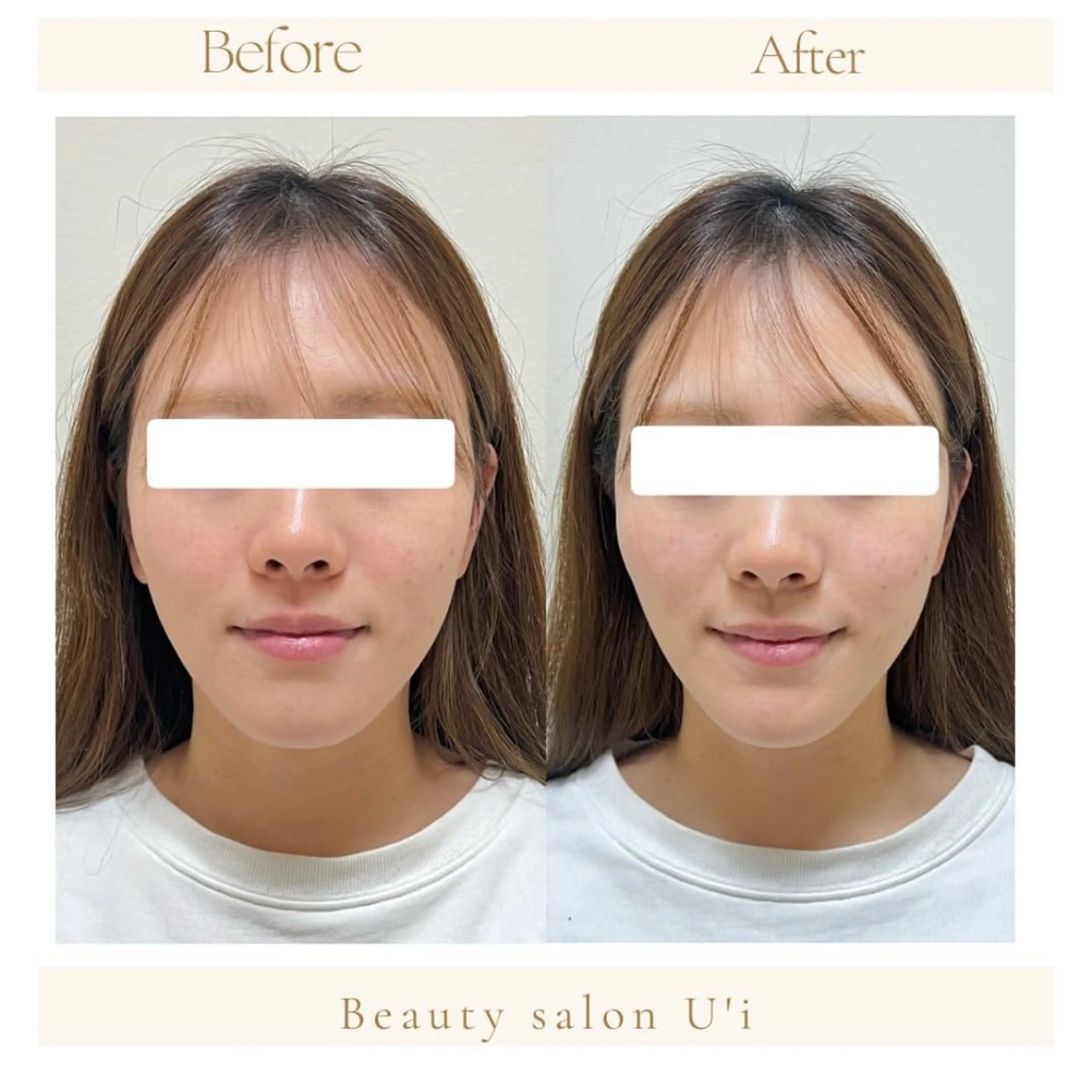 頭蓋骨小顔矯正 藤本のエステ・リラクイメージ