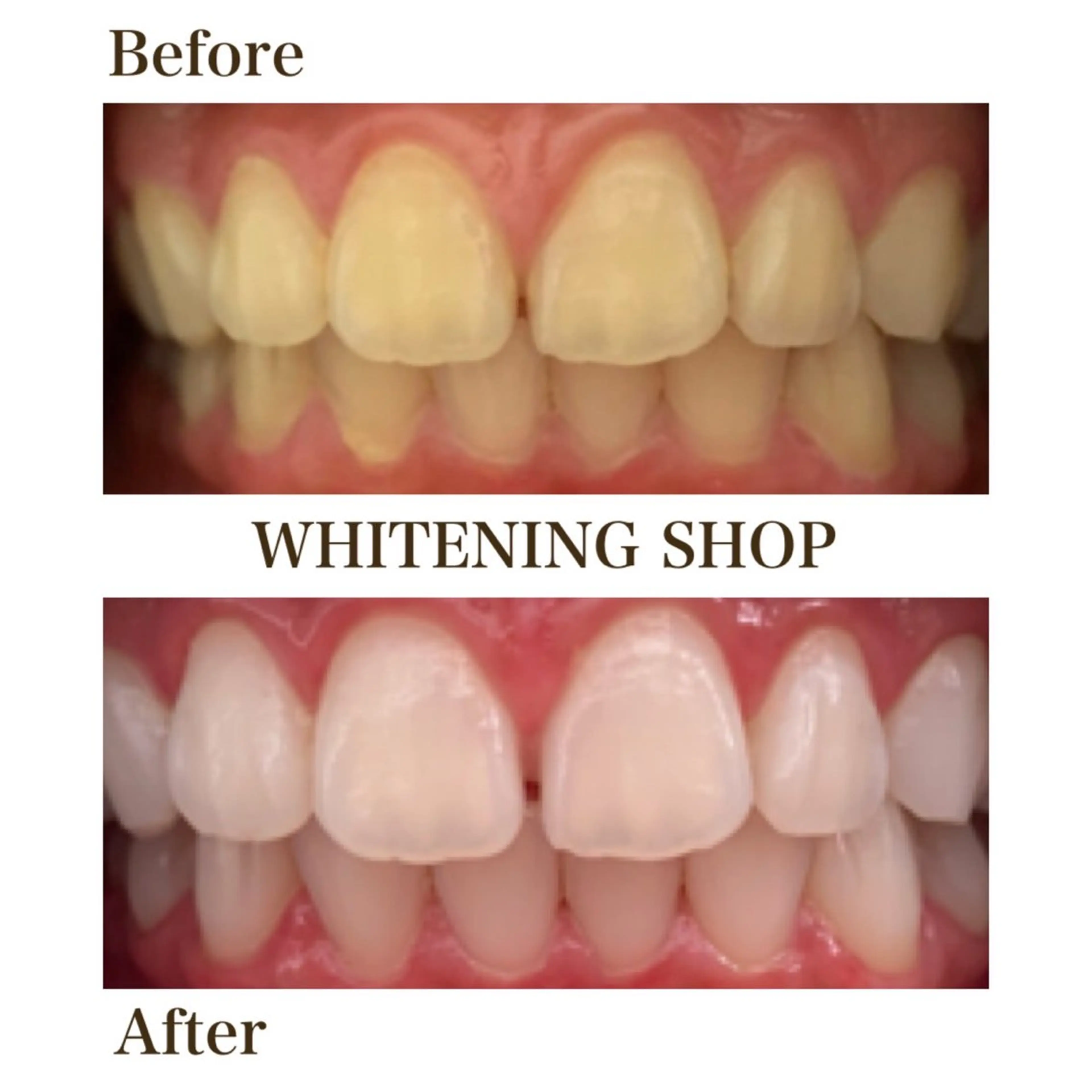 メンズ エステ リラク ホワイトニング ショップ川越店のエステ・リラクイメージ