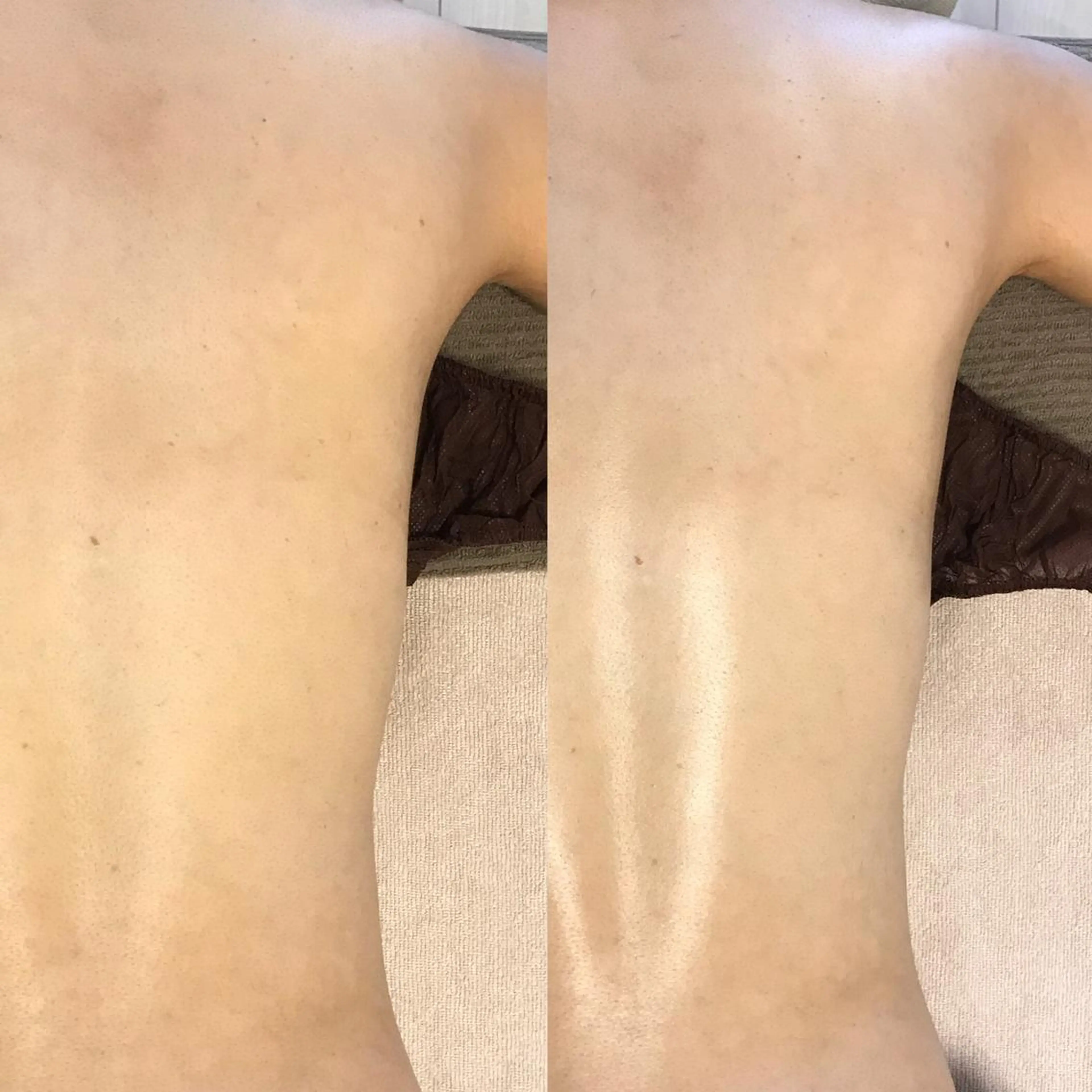 【バザルトボディ】（90分）の写真