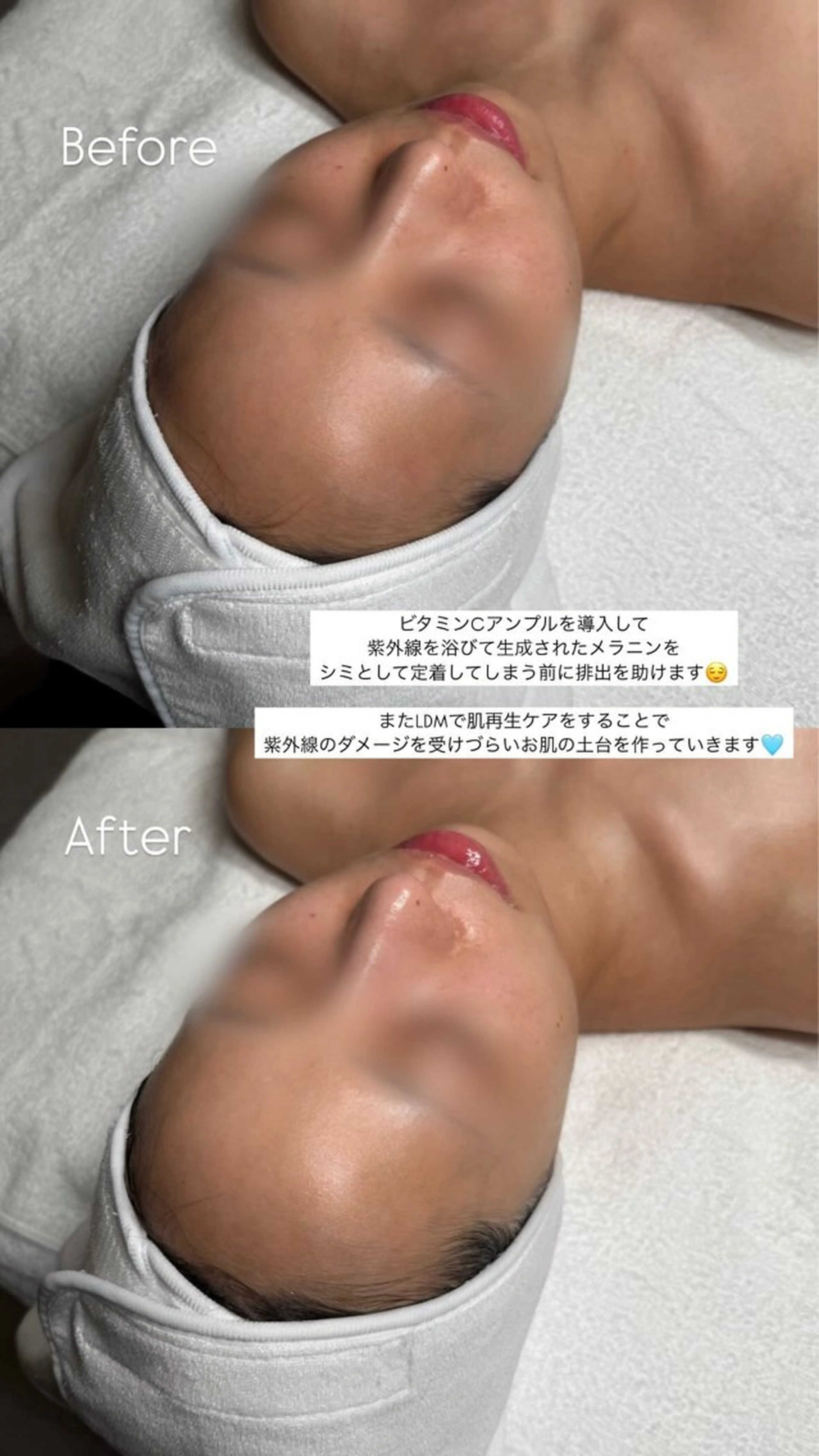 韓国肌管理🫧LDM 🫧Junnaのエステ・リラクイメージ