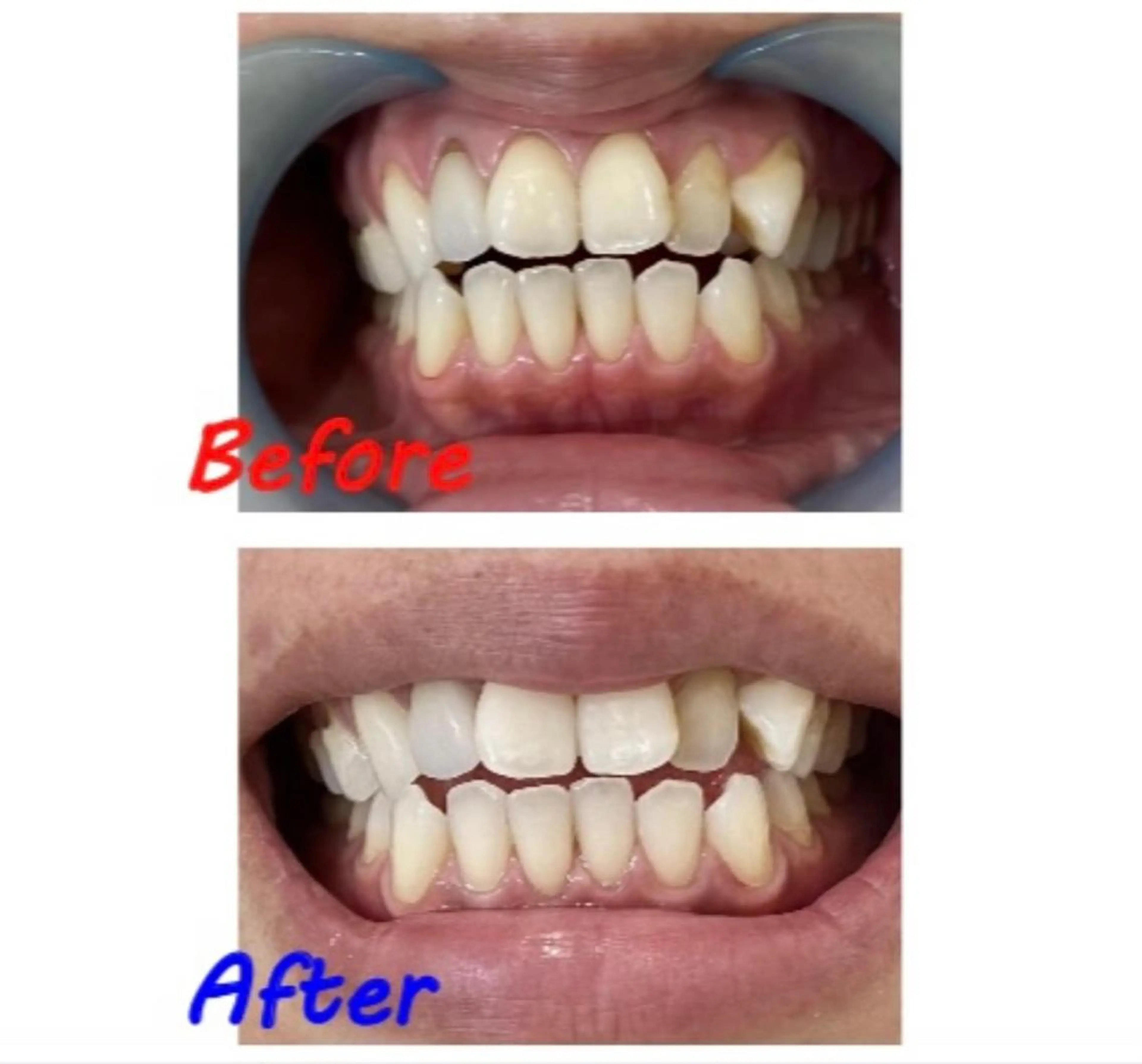 その他 セルフホワイトニングサロン　ラヴィアン所属・ホワイトニングサロン La vie enのその他イメージ