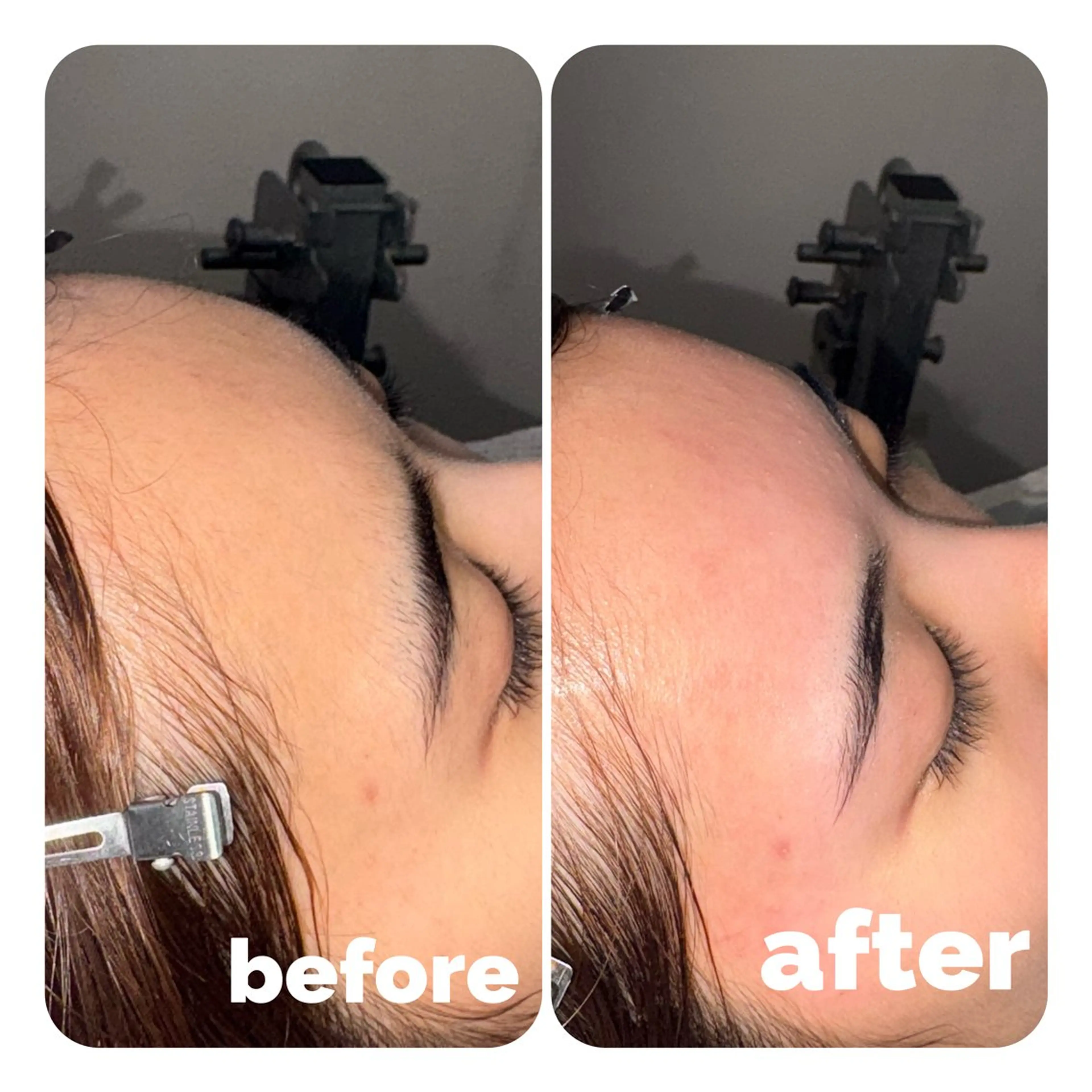 メンズもレディースも🉑！艶肌フェイスワックス【全顔】の写真