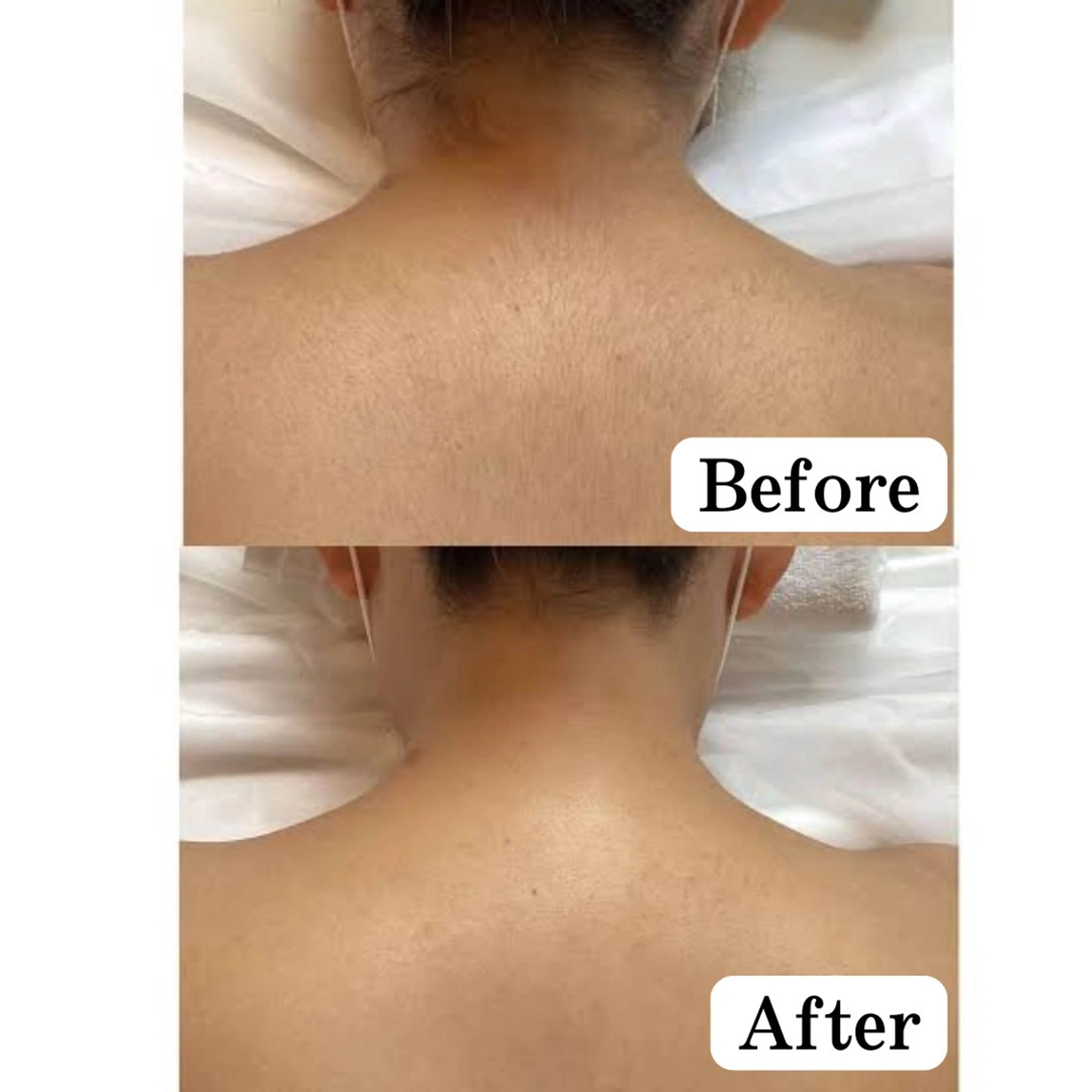 脱毛 美肌脱毛サロン muroのエステ・リラクイメージ