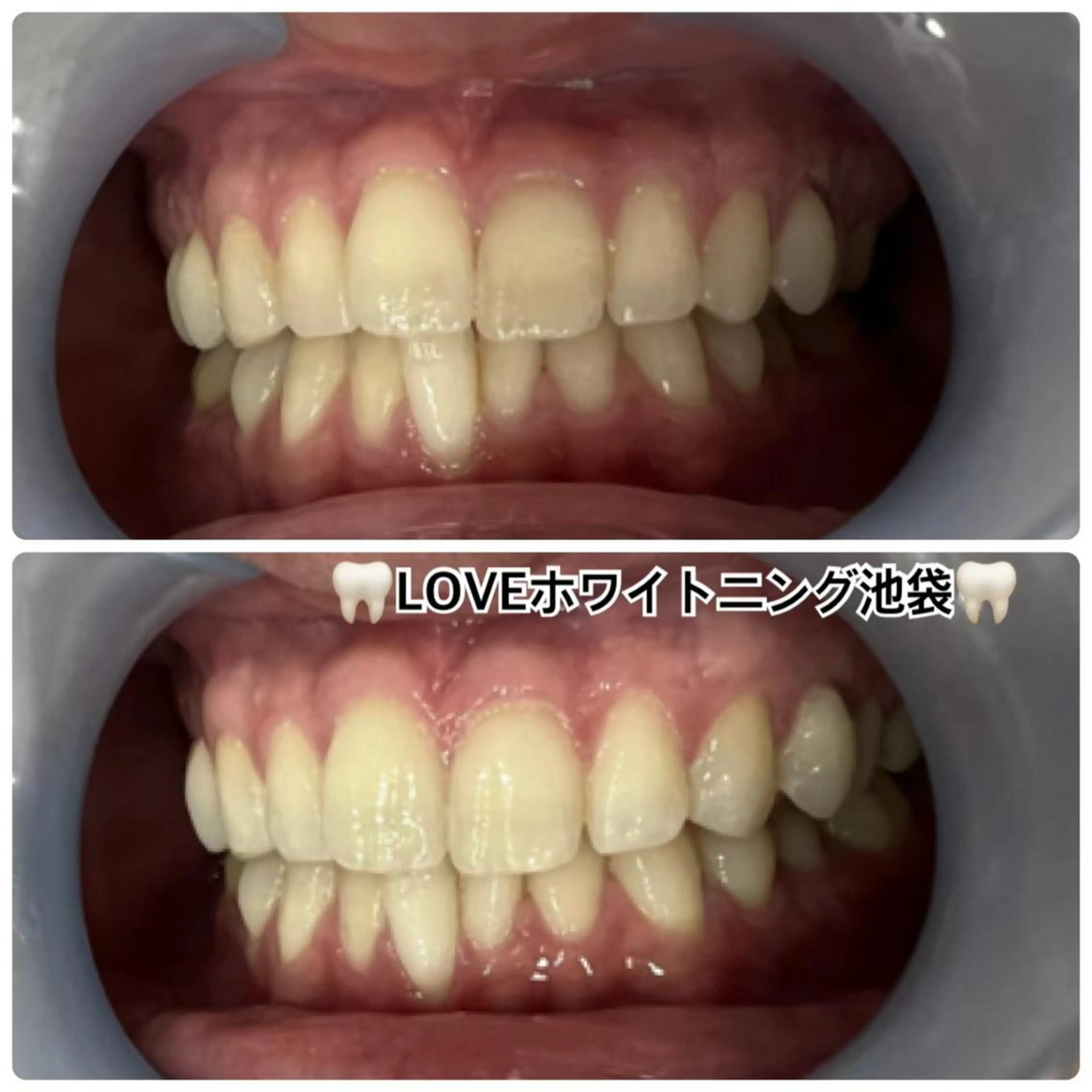 メンズ LOVEホワイト ニング恵比寿店のその他イメージ