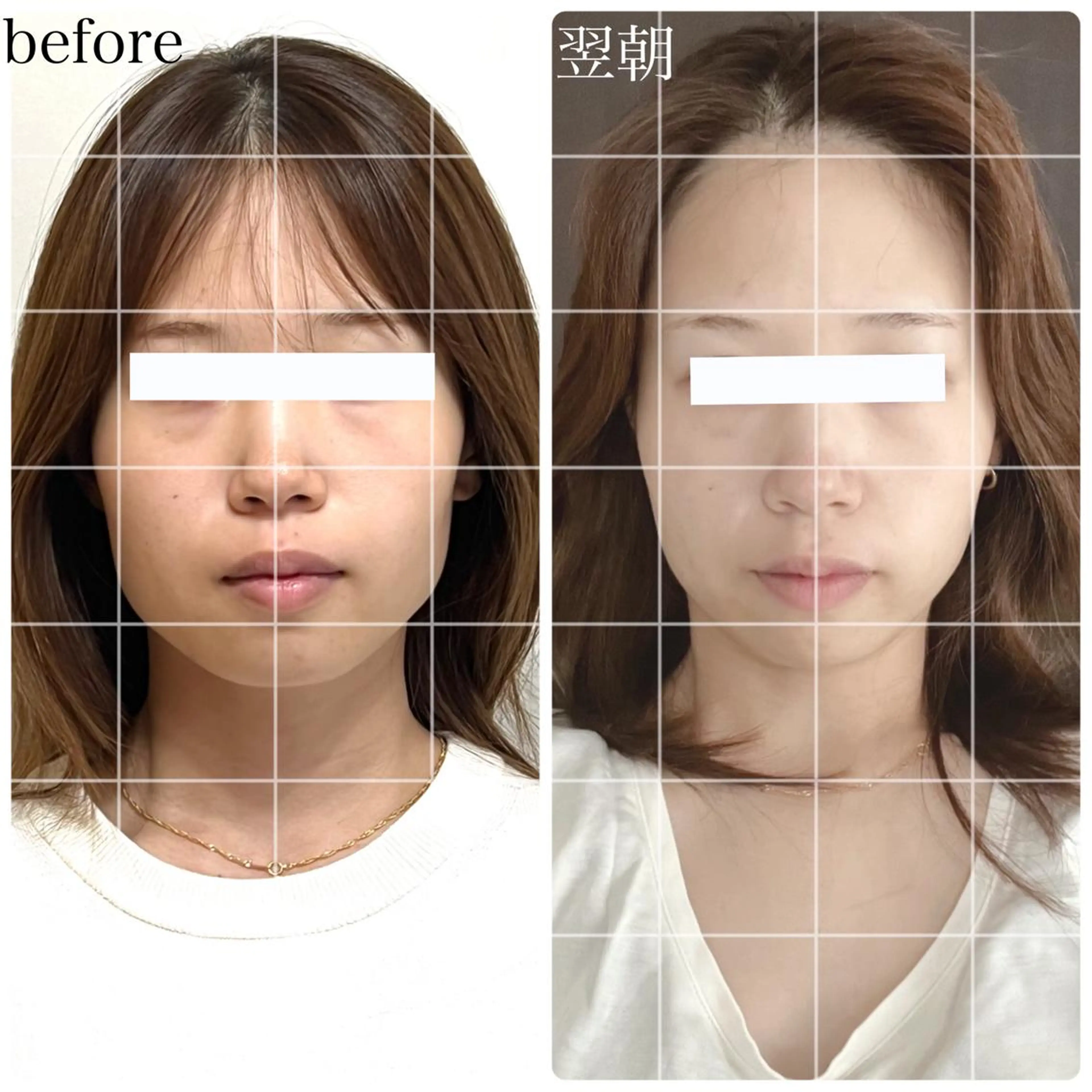 エステ リラク 小顔矯正ドライヘッド Arincoのエステ・リラクイメージ