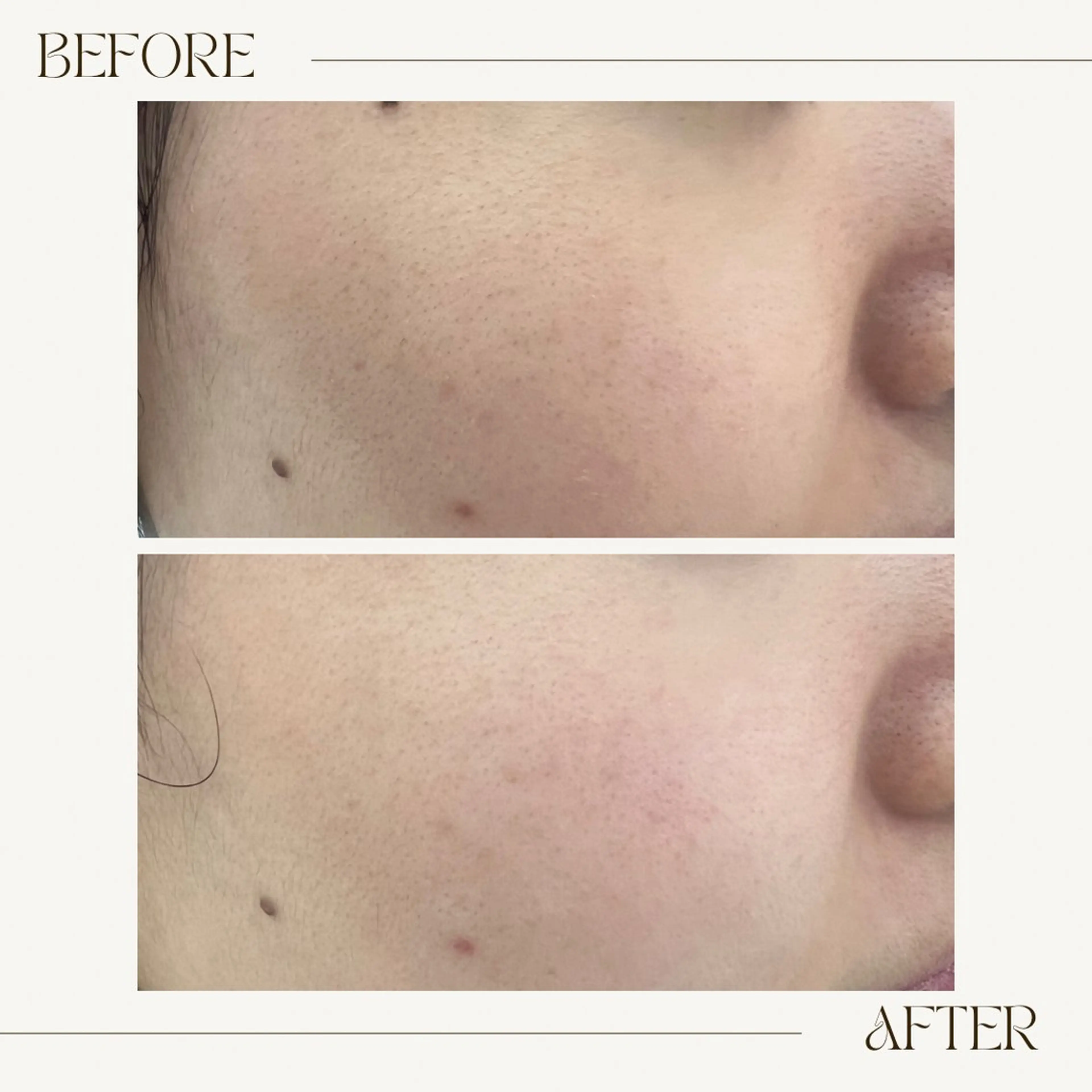 エステ GranDir所属・GranDir 堀井美沙のエステ・リラクイメージ