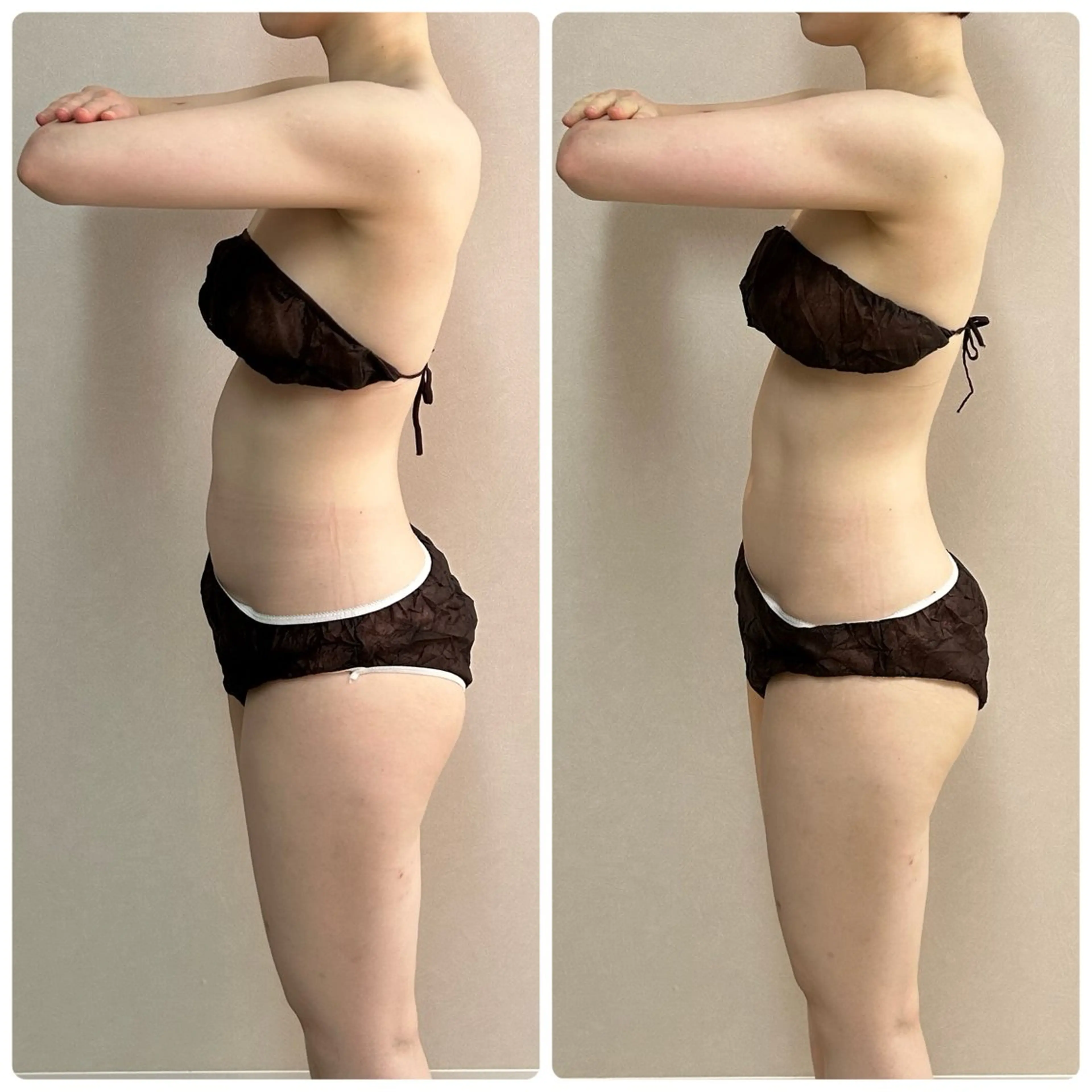 痩身メニュー💖 全身デトックス🔥 酵素浴＋ハイパーナイフ上半身or下半身 【モニター限定残り3名様】⚠️口コミ必須の写真