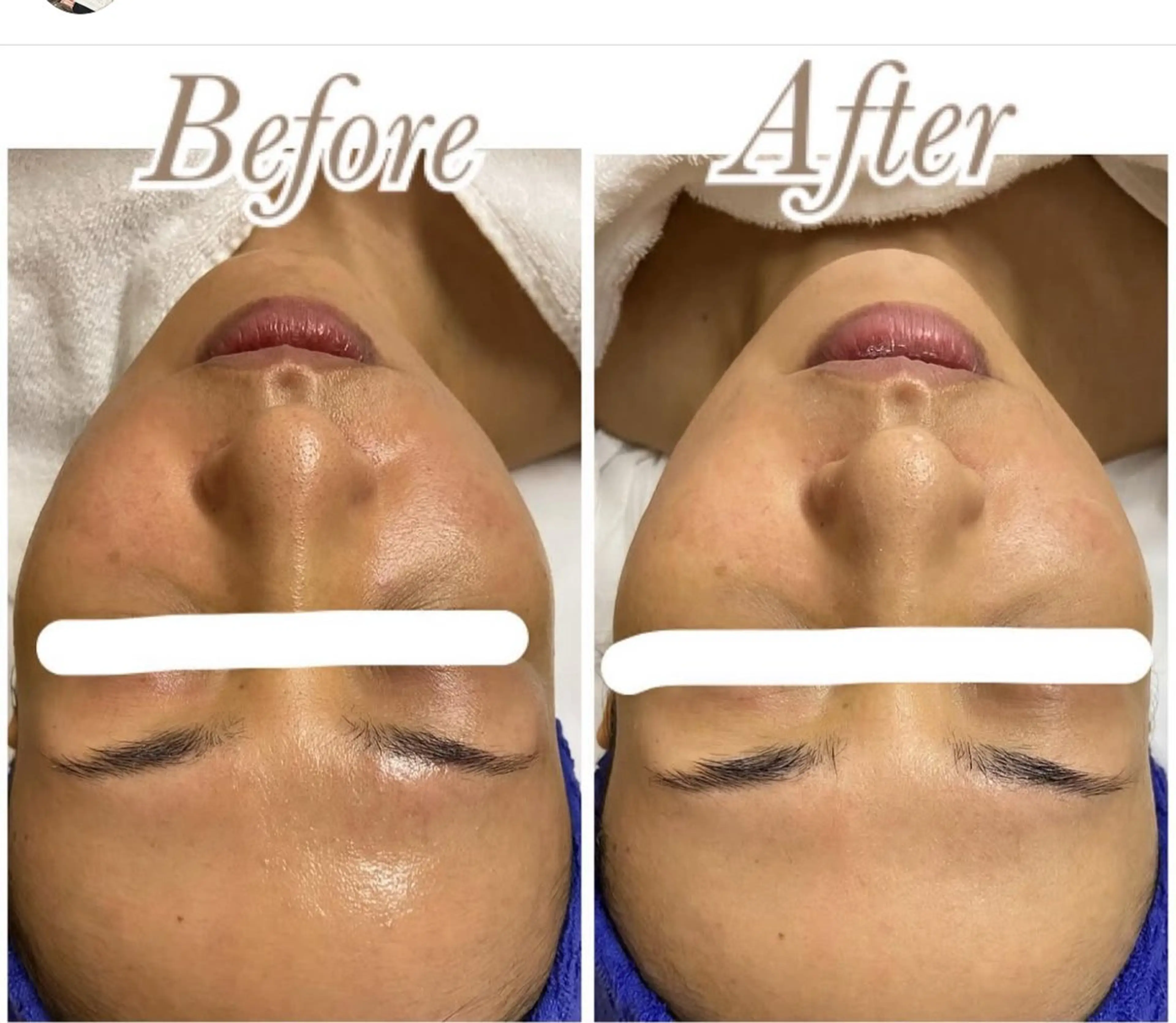 エステ ビューティーサロン　プリズム所属・久留本 茜のエステ・リラクイメージ