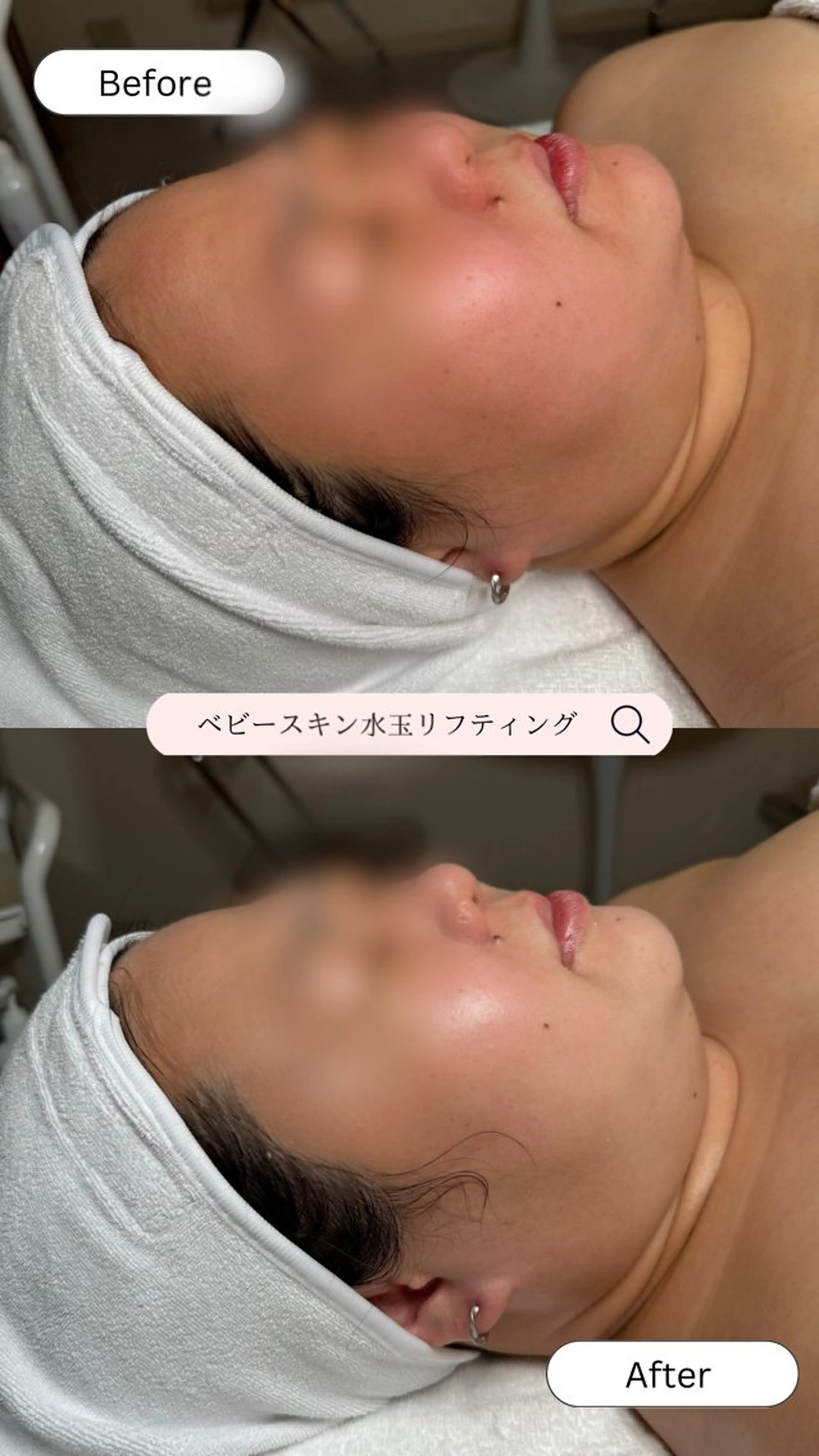 韓国肌管理🫧LDM 🫧Junnaのエステ・リラクイメージ