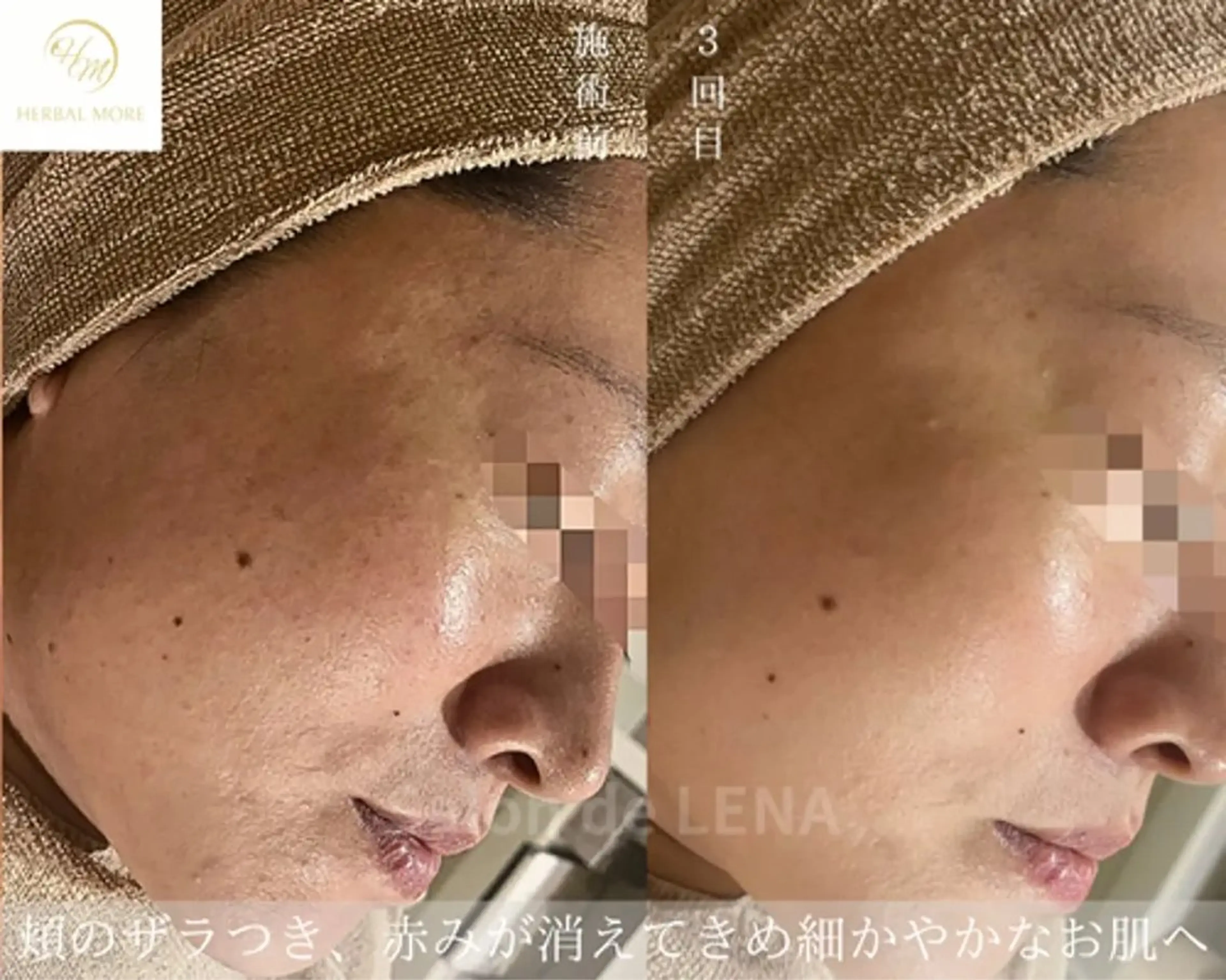 Grandir所属・ハーブピーリング専門 グランディール　武内のエステ・リラクイメージ