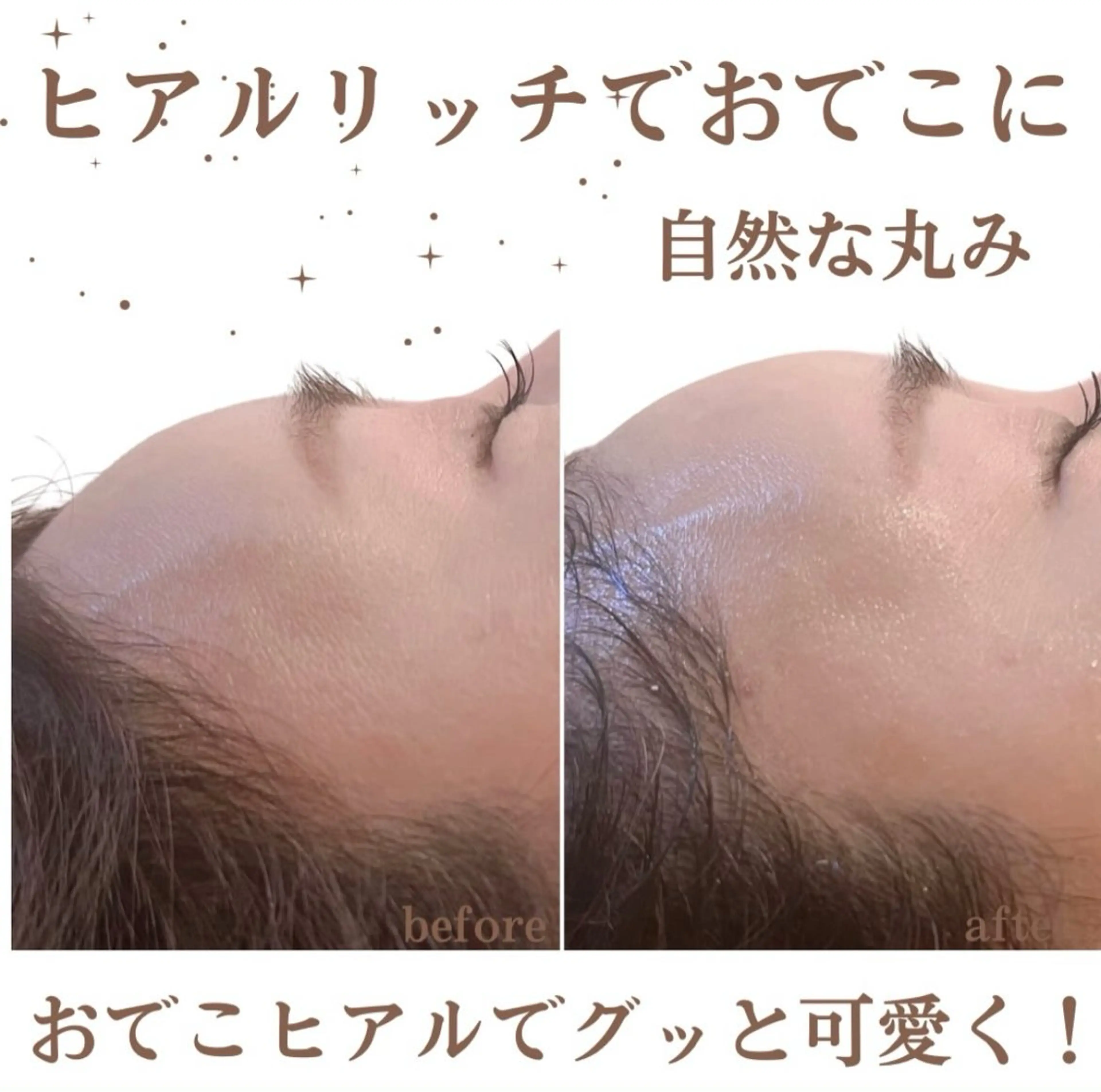 小顔/たるみ/黒ずみ除去専門サロン/SONA 大和西大寺店所属・【小顔専門看護師 サロンSONA】のエステ・リラクイメージ