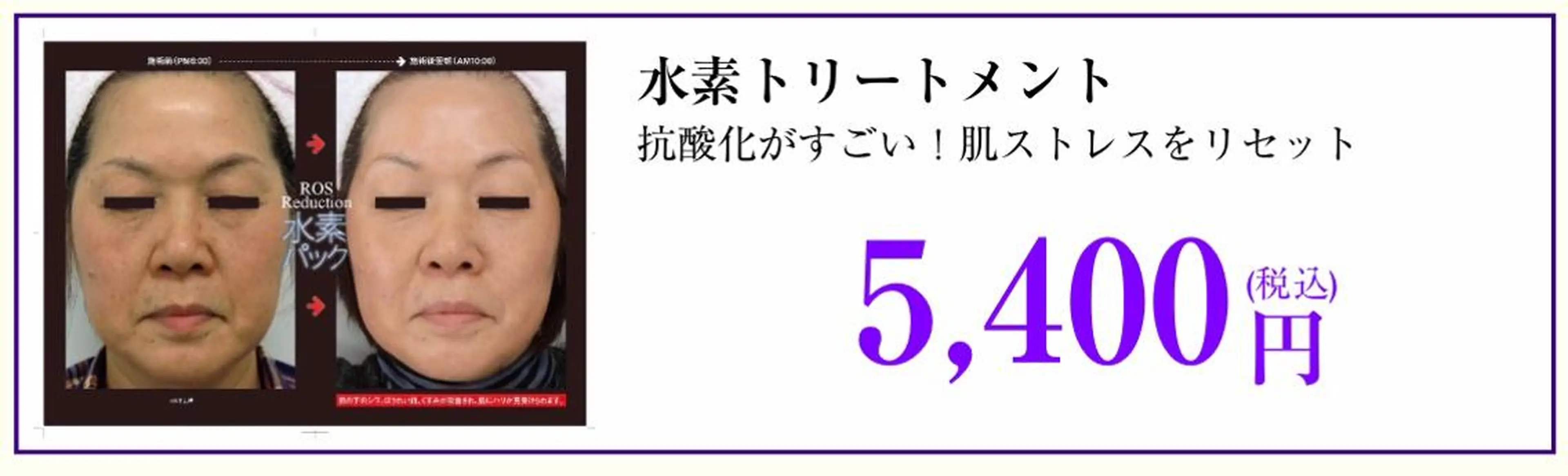 カラー ネイル マツエク・マツパ 代表 MOMOのエステ・リラクイメージ