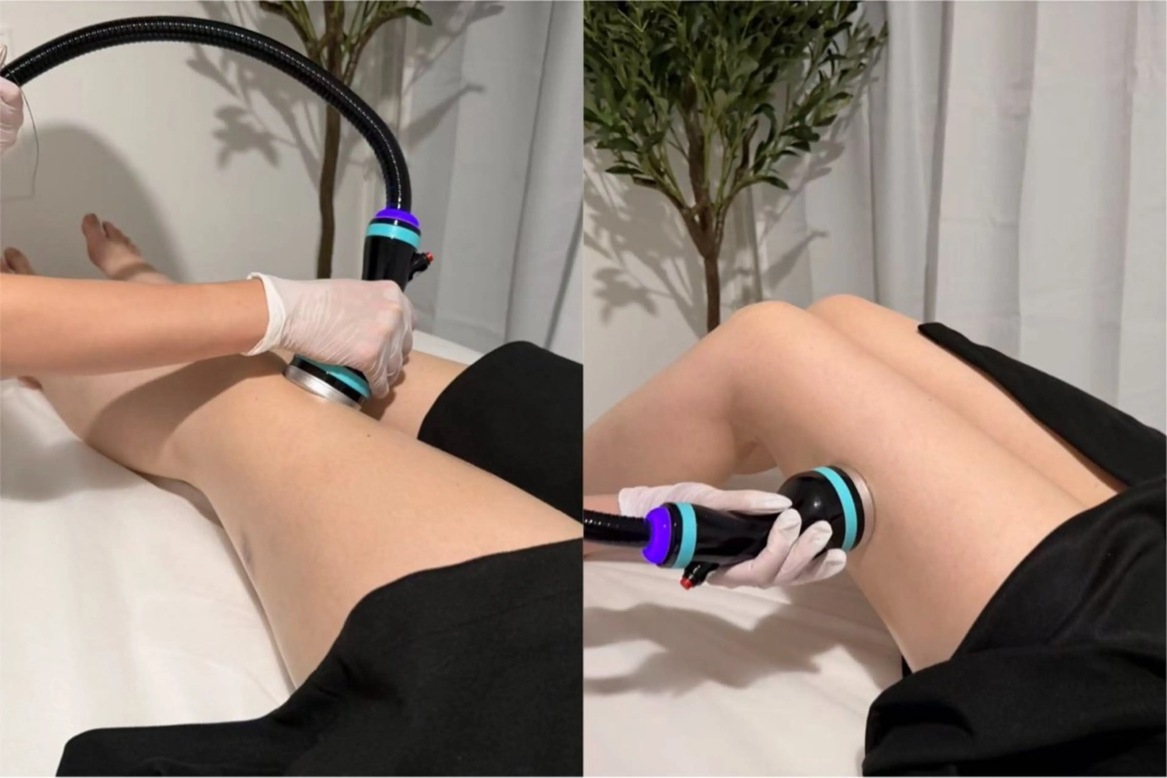 オンダリフト30分｜両太もも100kj~200kjの写真