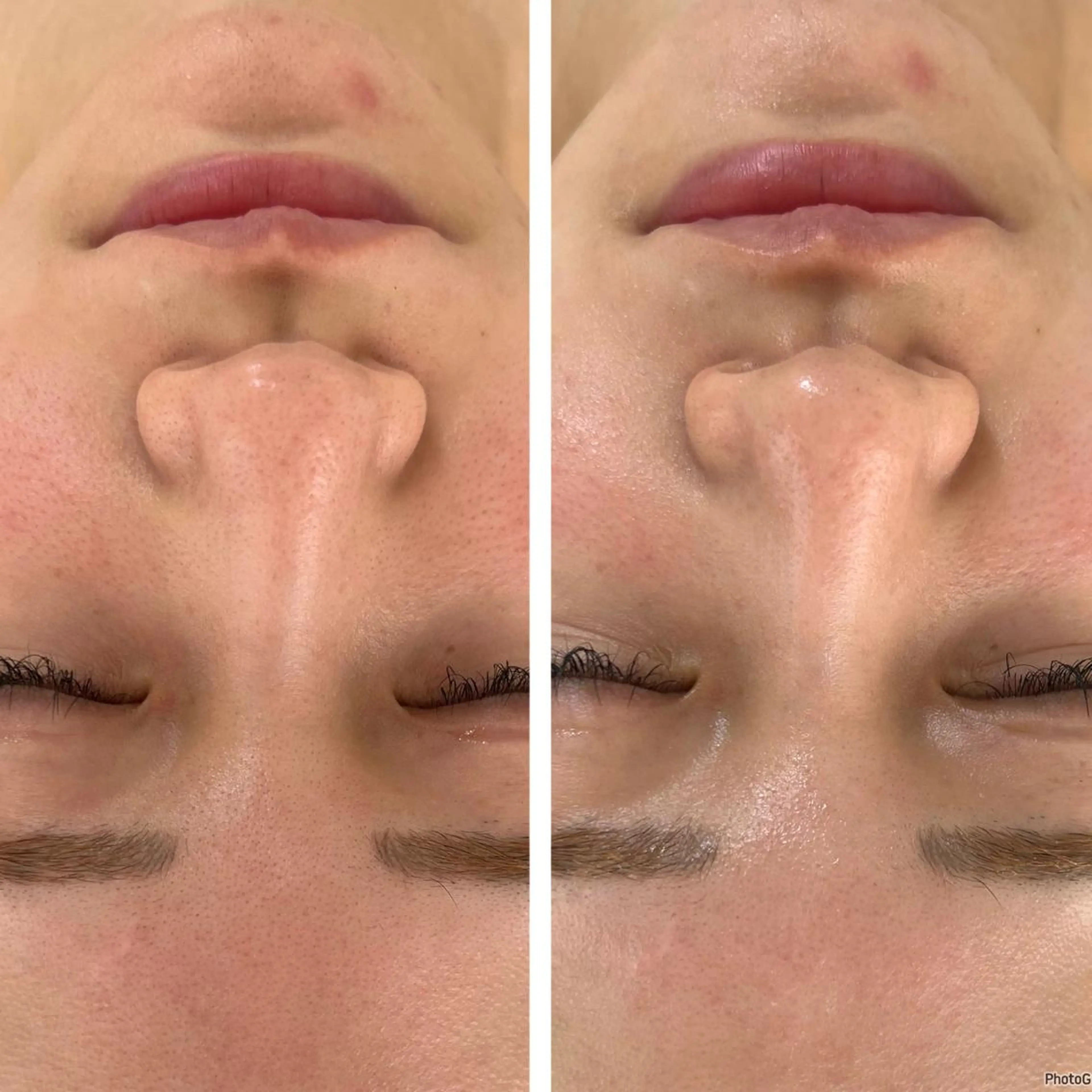 エステ 脱毛＆Beauty salon IILA所属・垢抜けお手伝い💖 Sakuraの眉毛・アイブロウイメージ