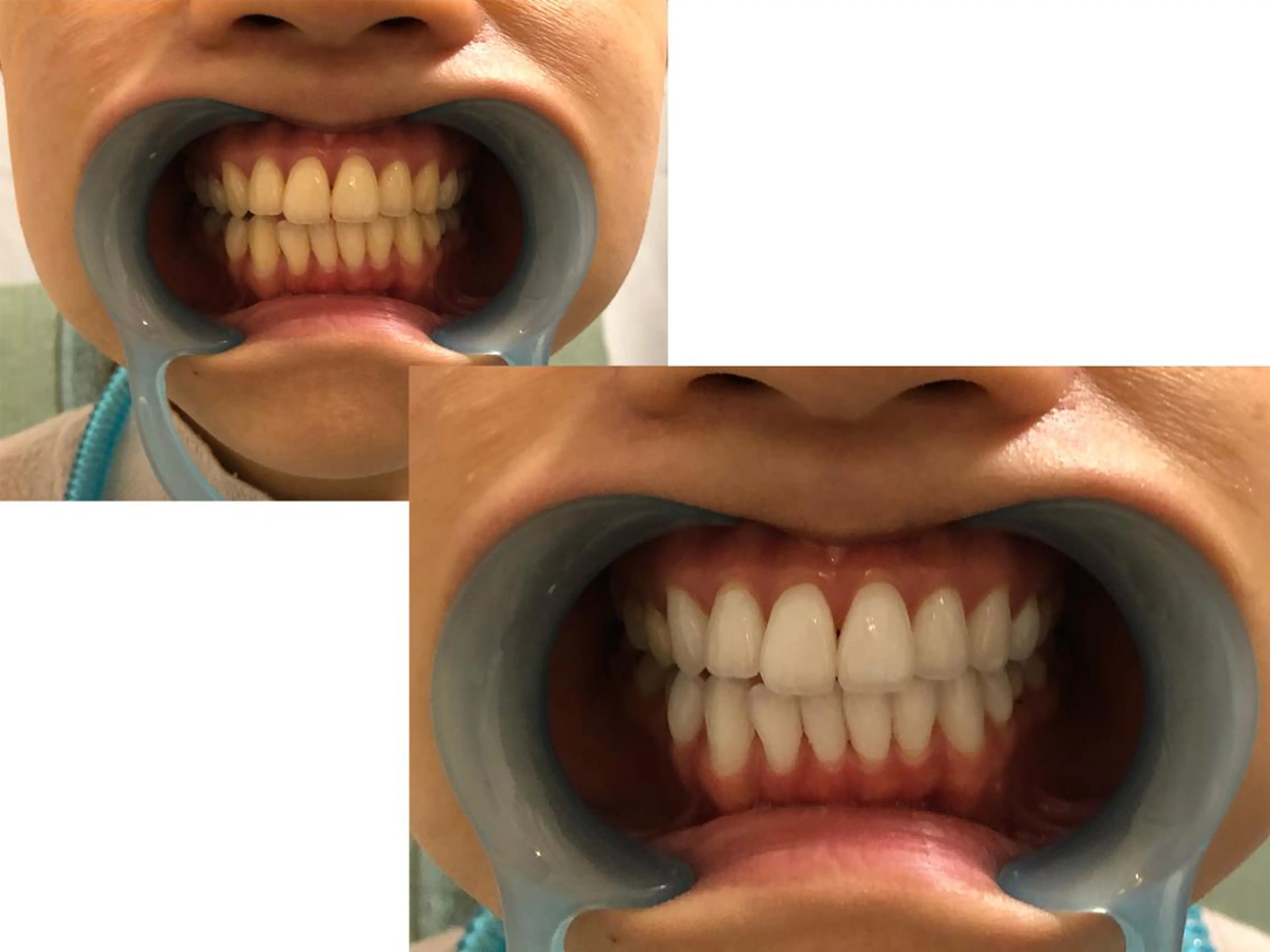 ショート カラー キッズ パーマ ヘアアレンジ メンズ アイブロウ マツエク・マツパ ネイル 結婚式・ブライダル 結婚式・ブライダル バレンタイン ブライダルネイル ホワイト 中目黒 ホワイトニングサロンのその他イメージ